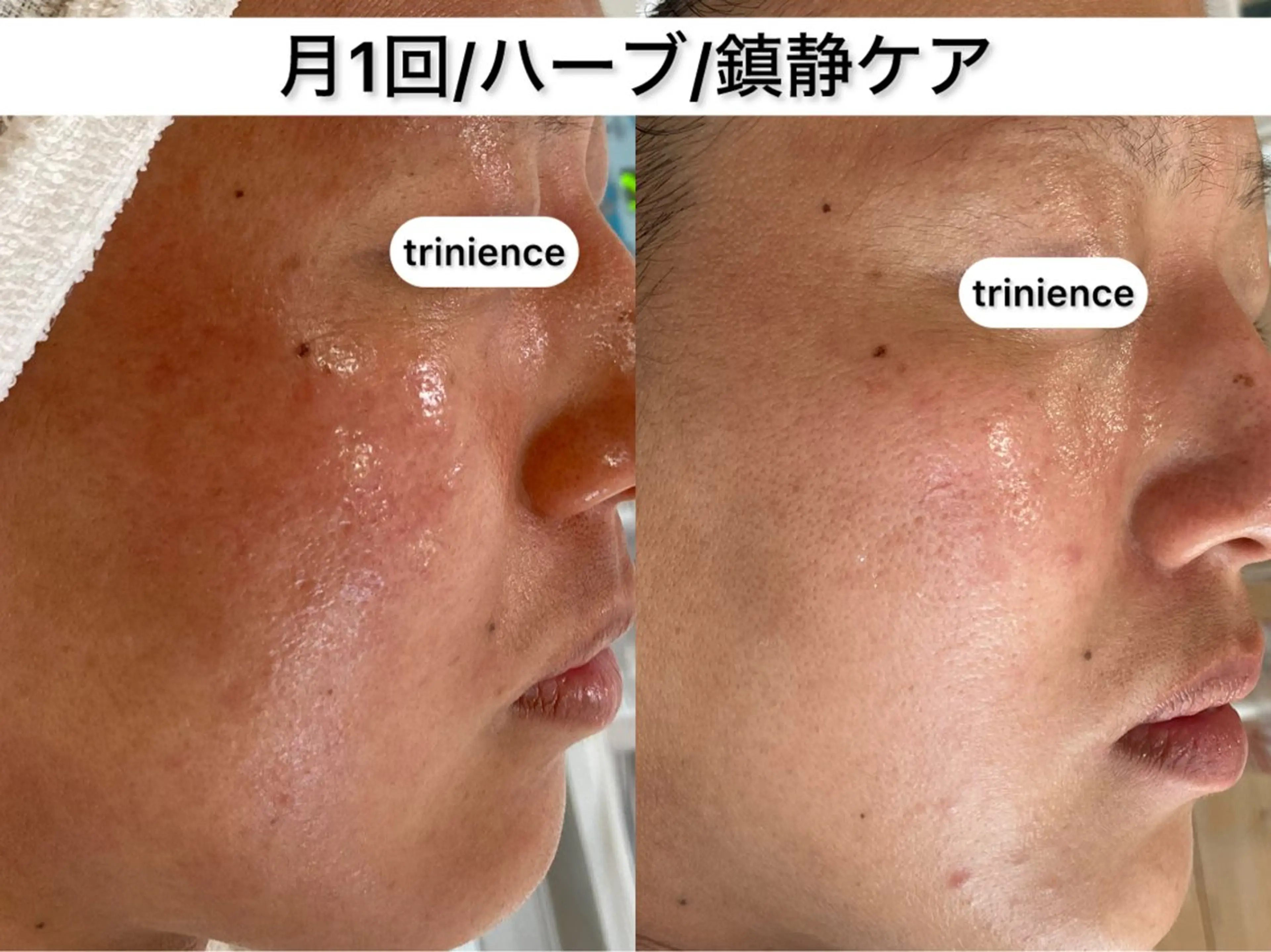 TRINIENCE 南流山店のエステ・リラクイメージ