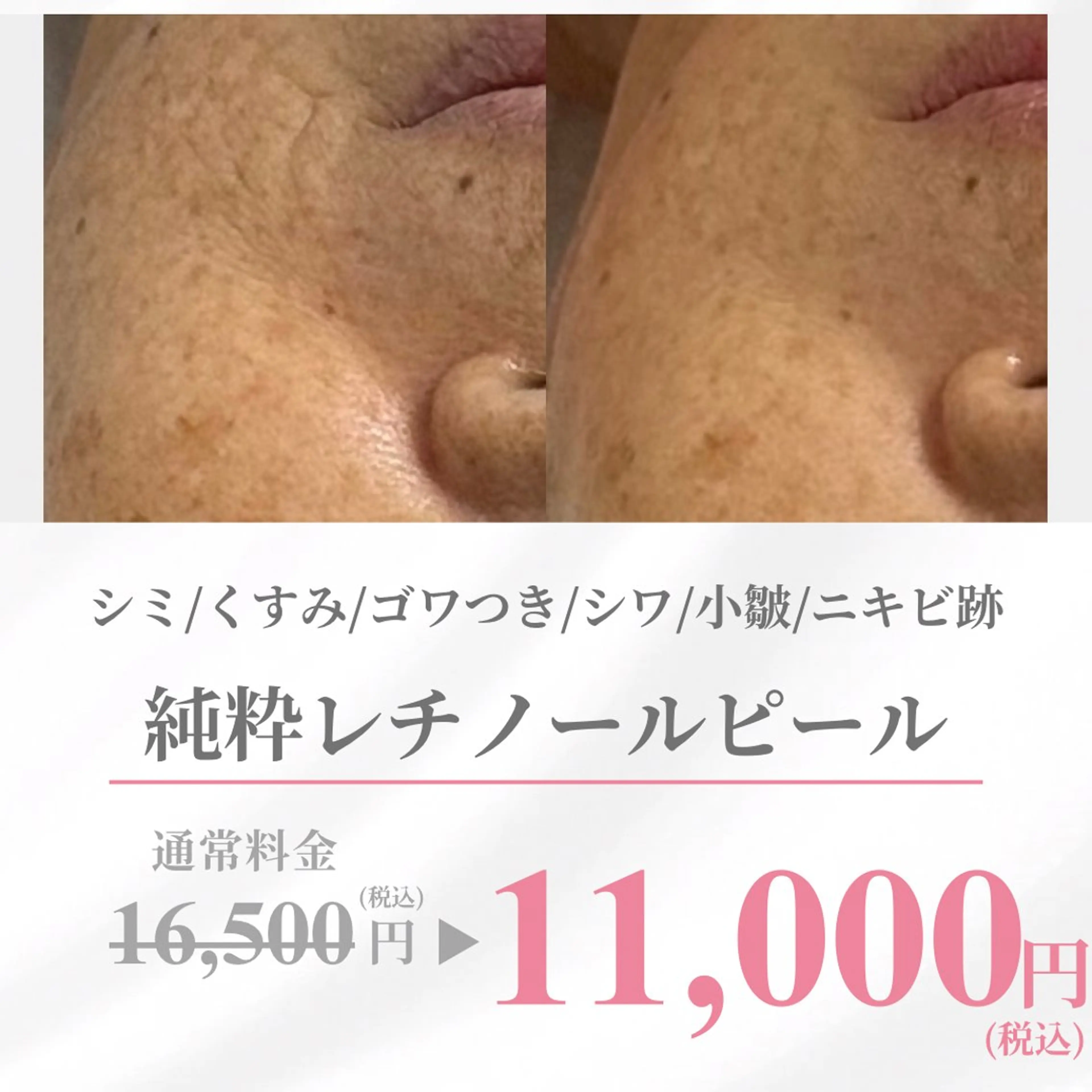 ALIA Scintiller  アリアサンティエ所属・齋藤 祐里耶のエステ・リラクイメージ