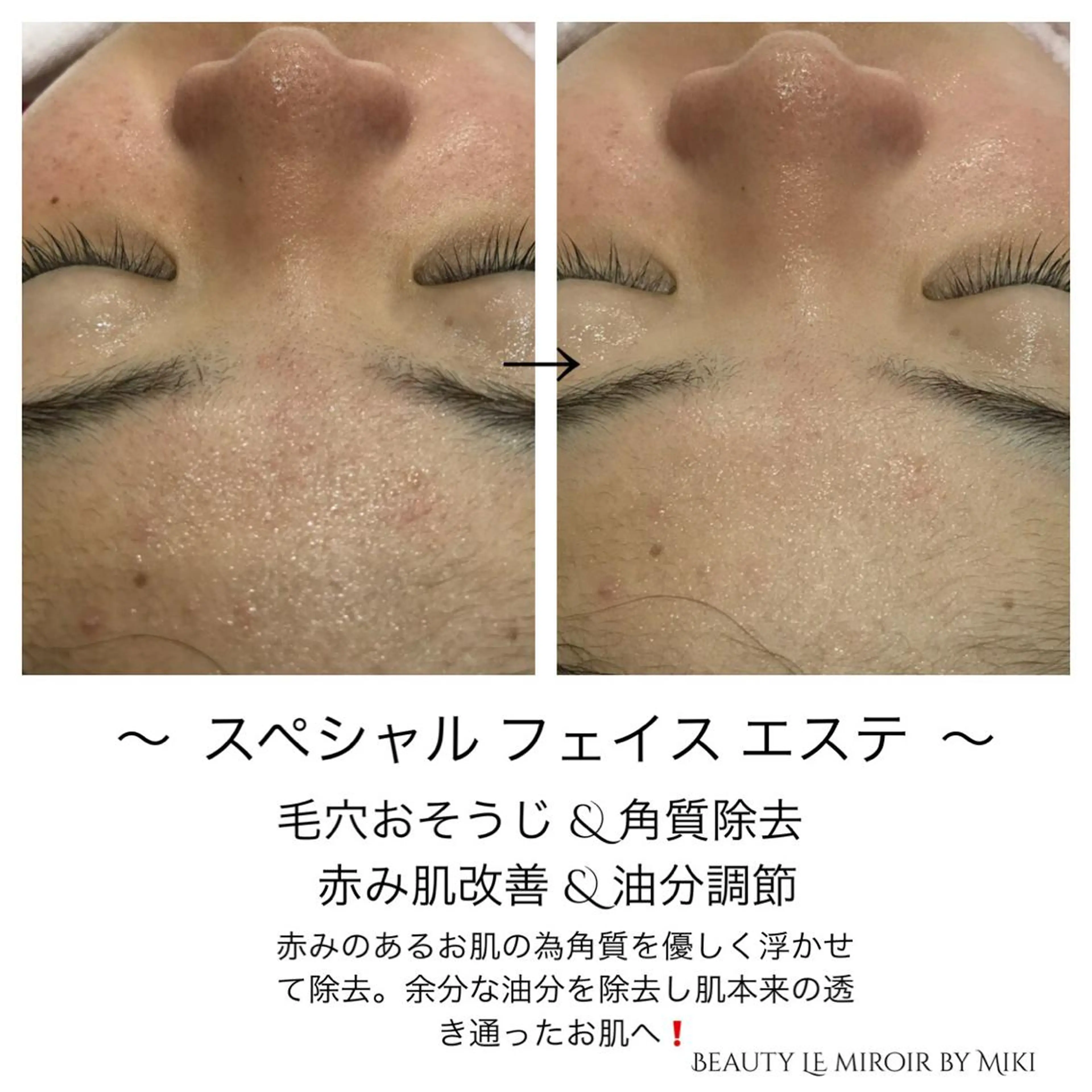 ビューティー ミロワールのエステ・リラクイメージ