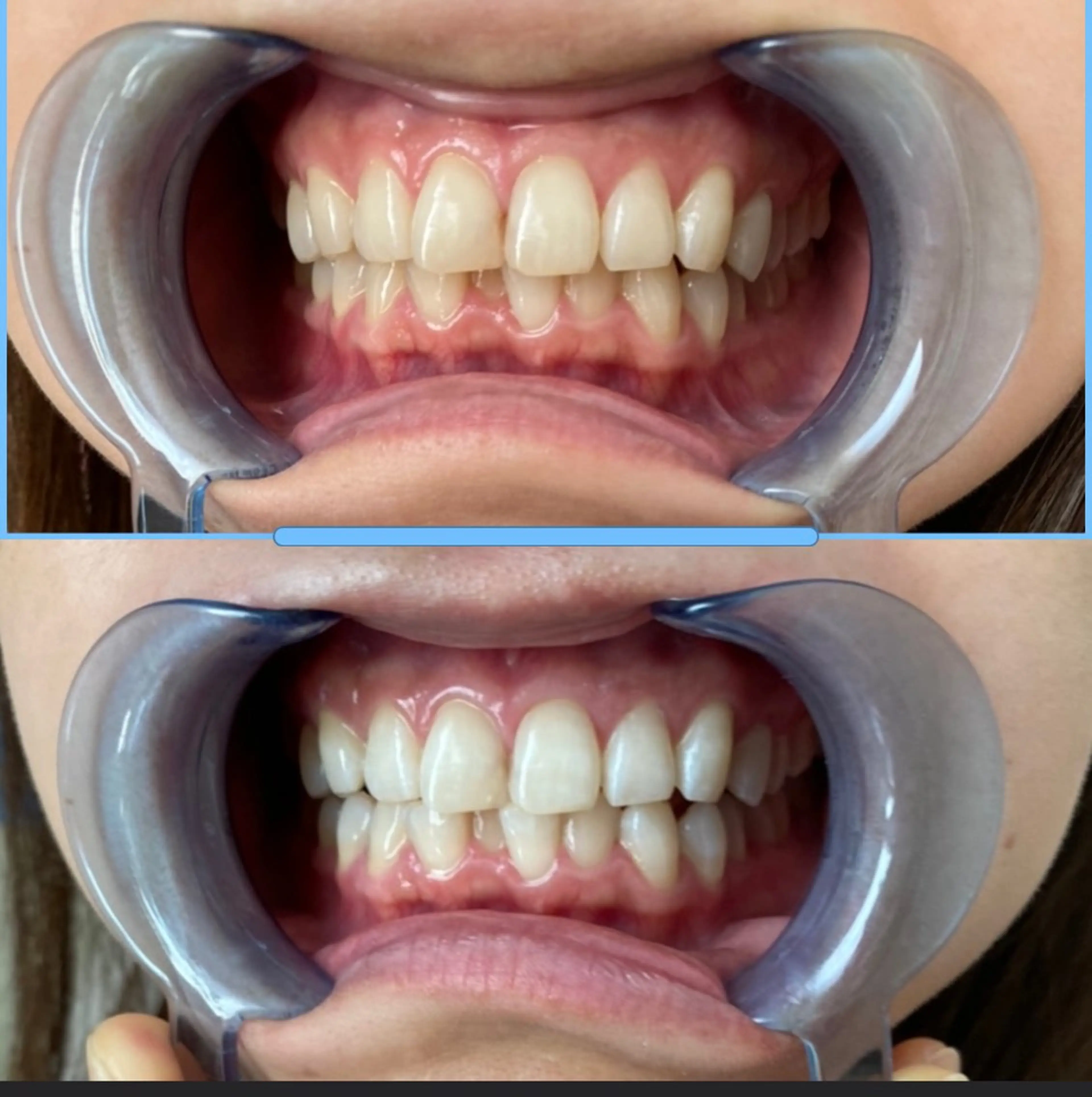 R E O T I A R A（レオティアラ）所属・高屋 昌子のその他イメージ