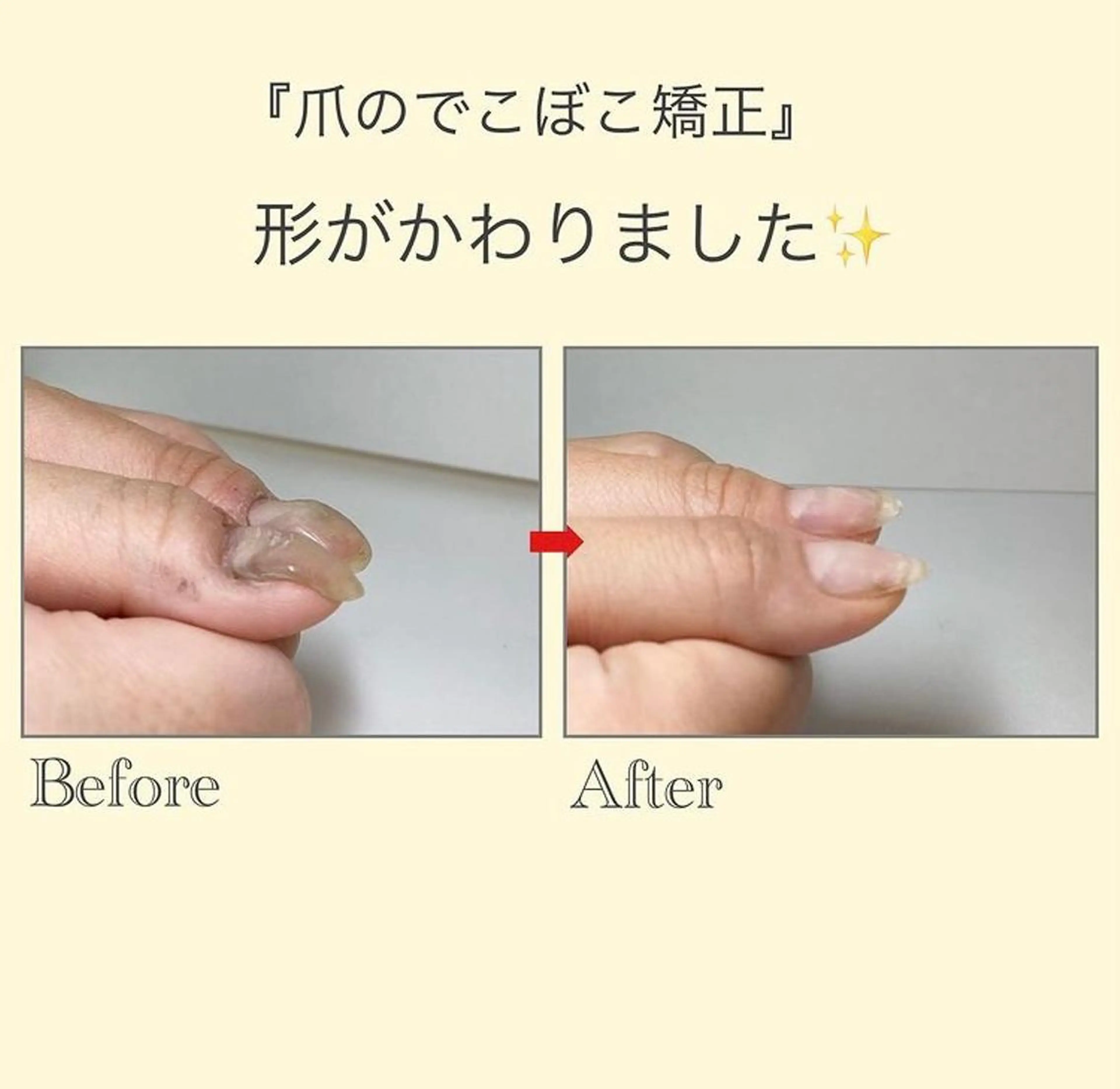 ネイル ネイルサロン アリュームのネイルデザイン