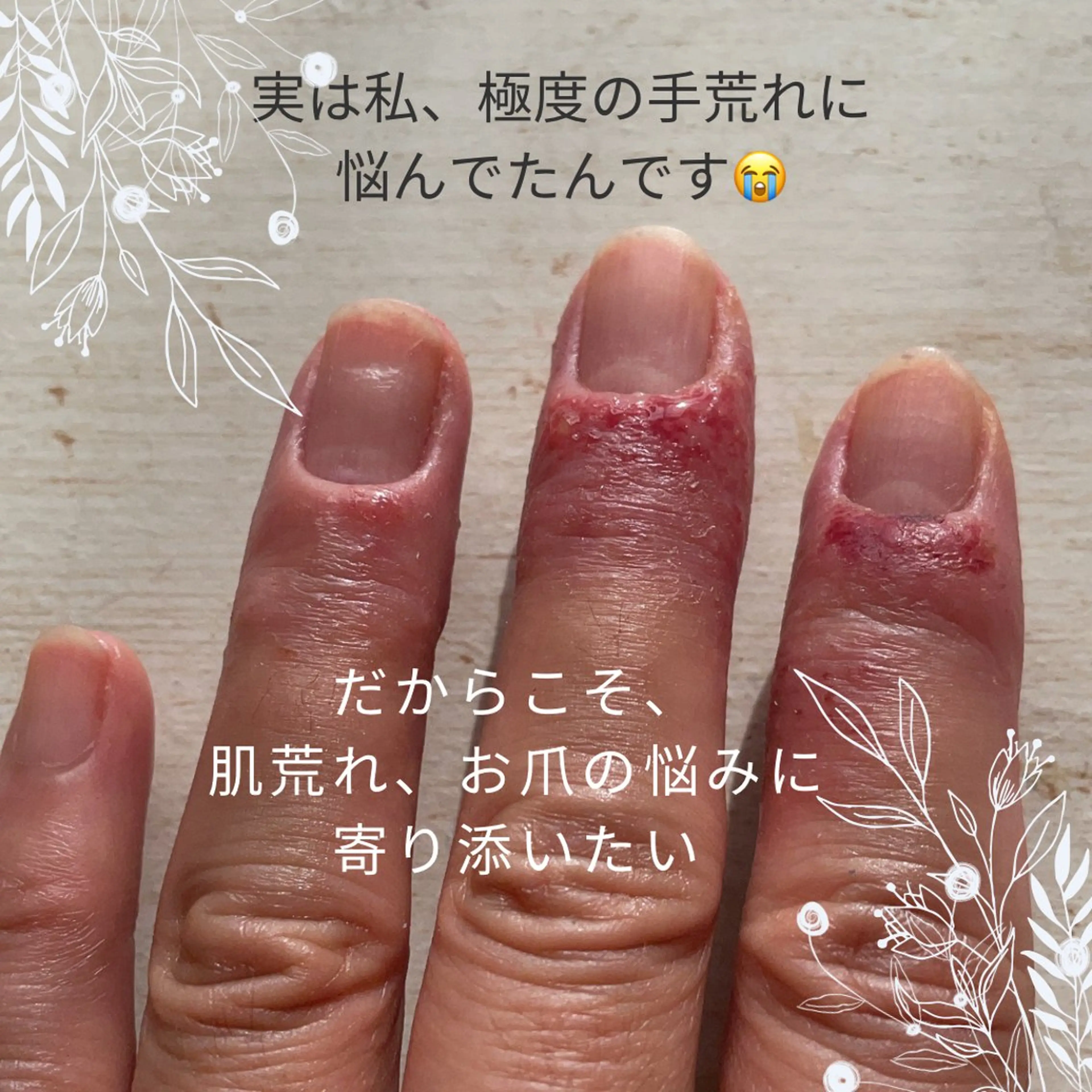 ネイル 荒井 恵のネイルデザイン