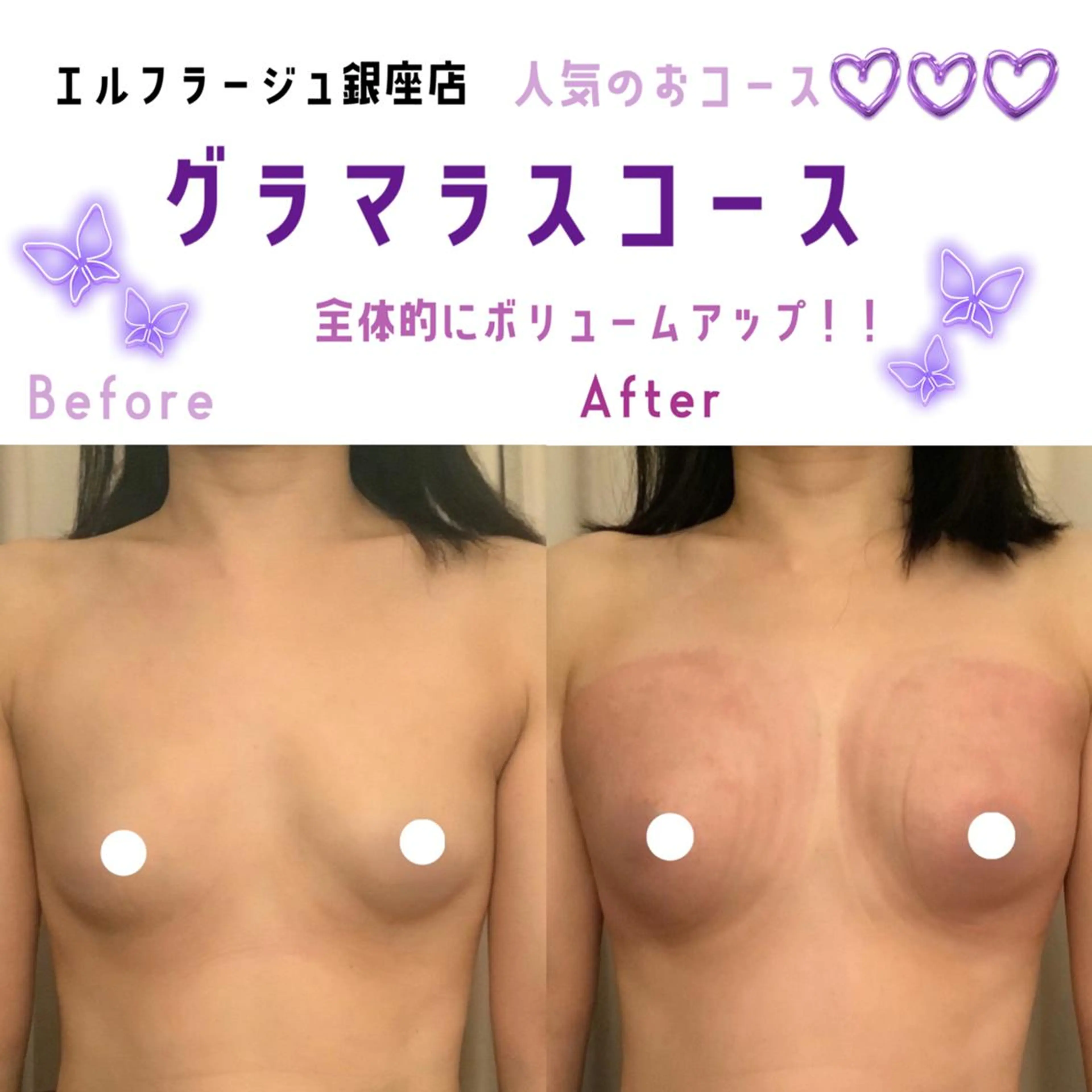 エルフラージュ 銀座店のエステ・リラクイメージ