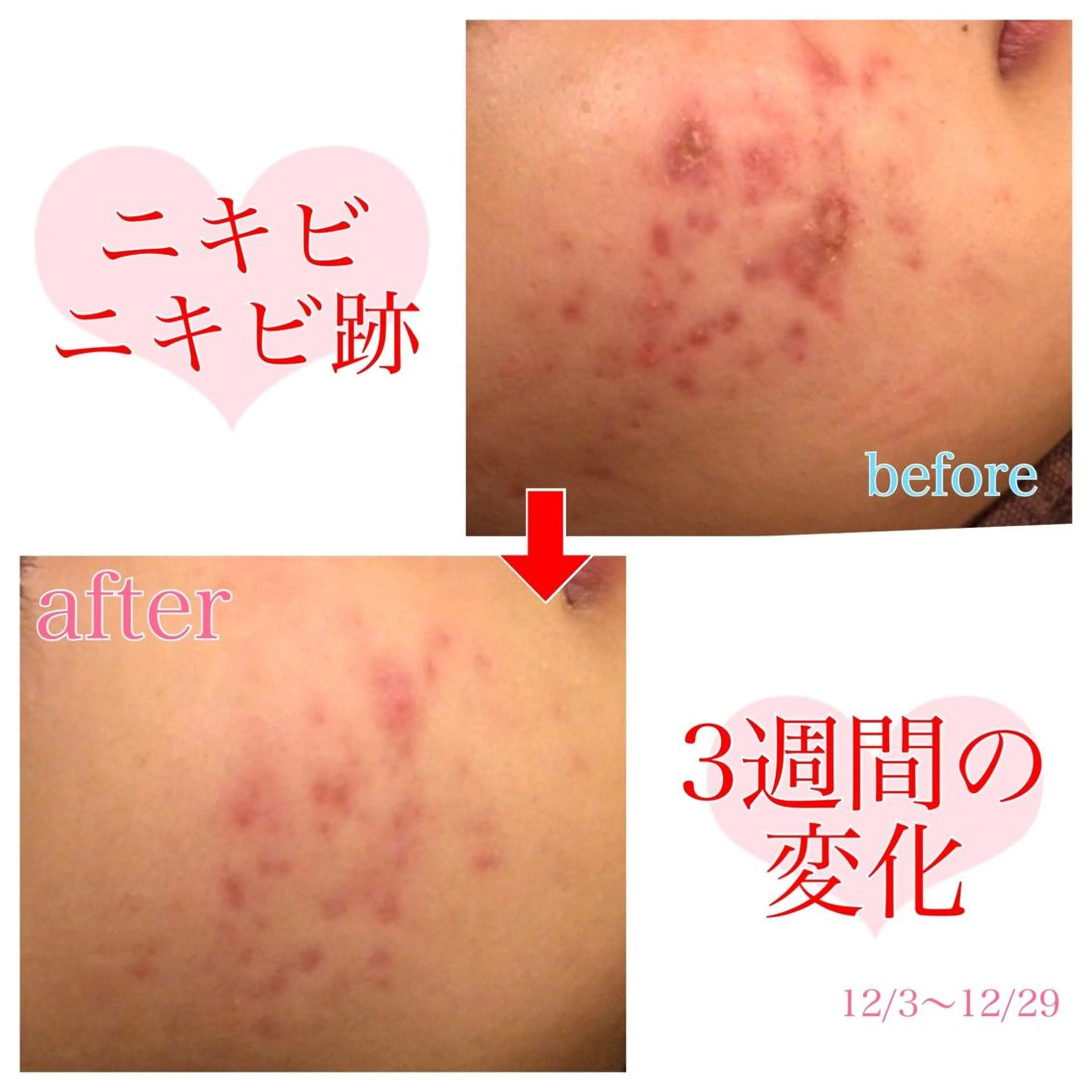 セミロング カラー パーマ ヘアアレンジ メンズ キッズ ネイル マツエク・マツパ 金の糸脱毛 産毛ケア専門のエステ・リラクイメージ