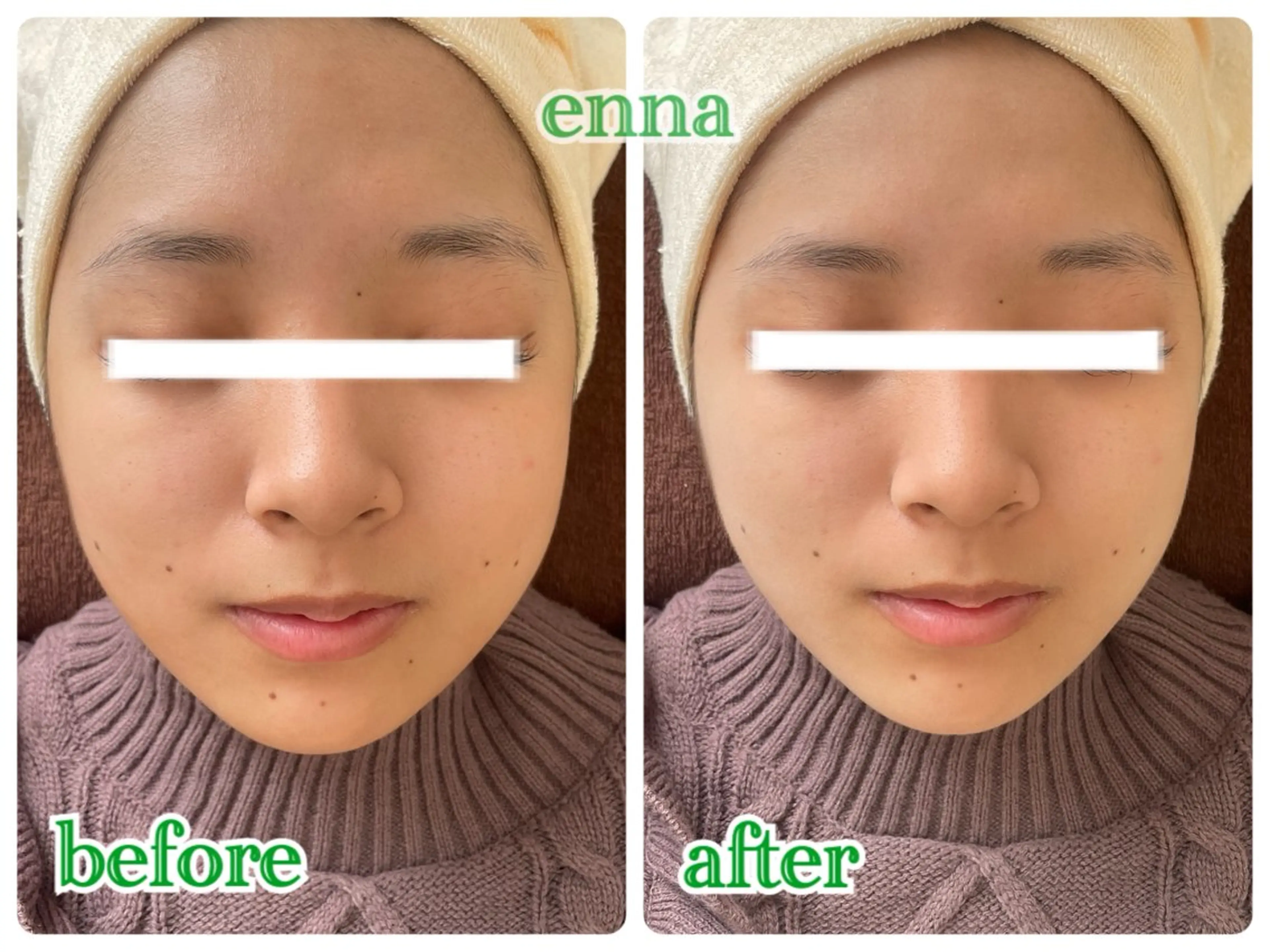 三上 笑里奈のエステ・リラクイメージ