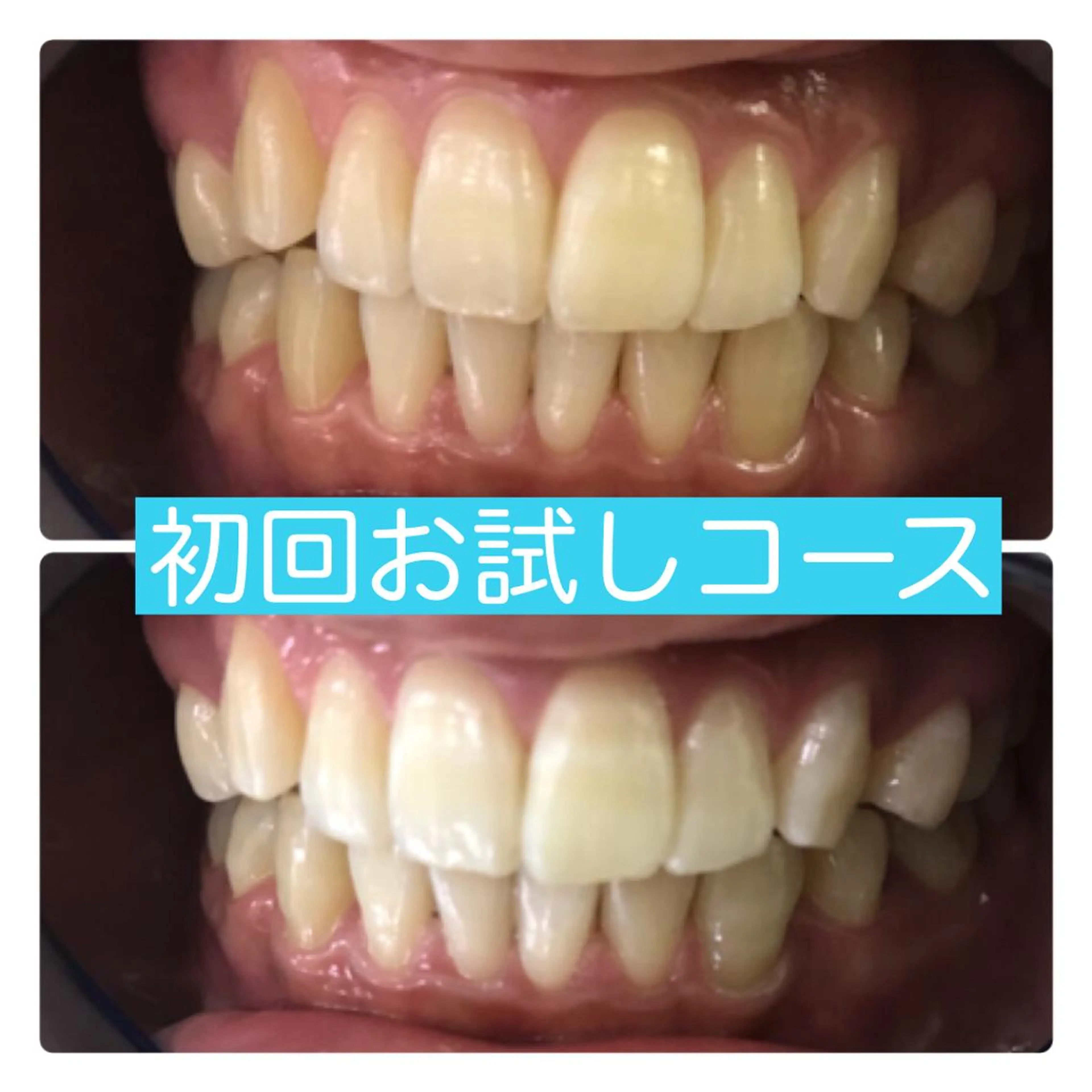 ホワイトニングルーム 横浜店のその他イメージ