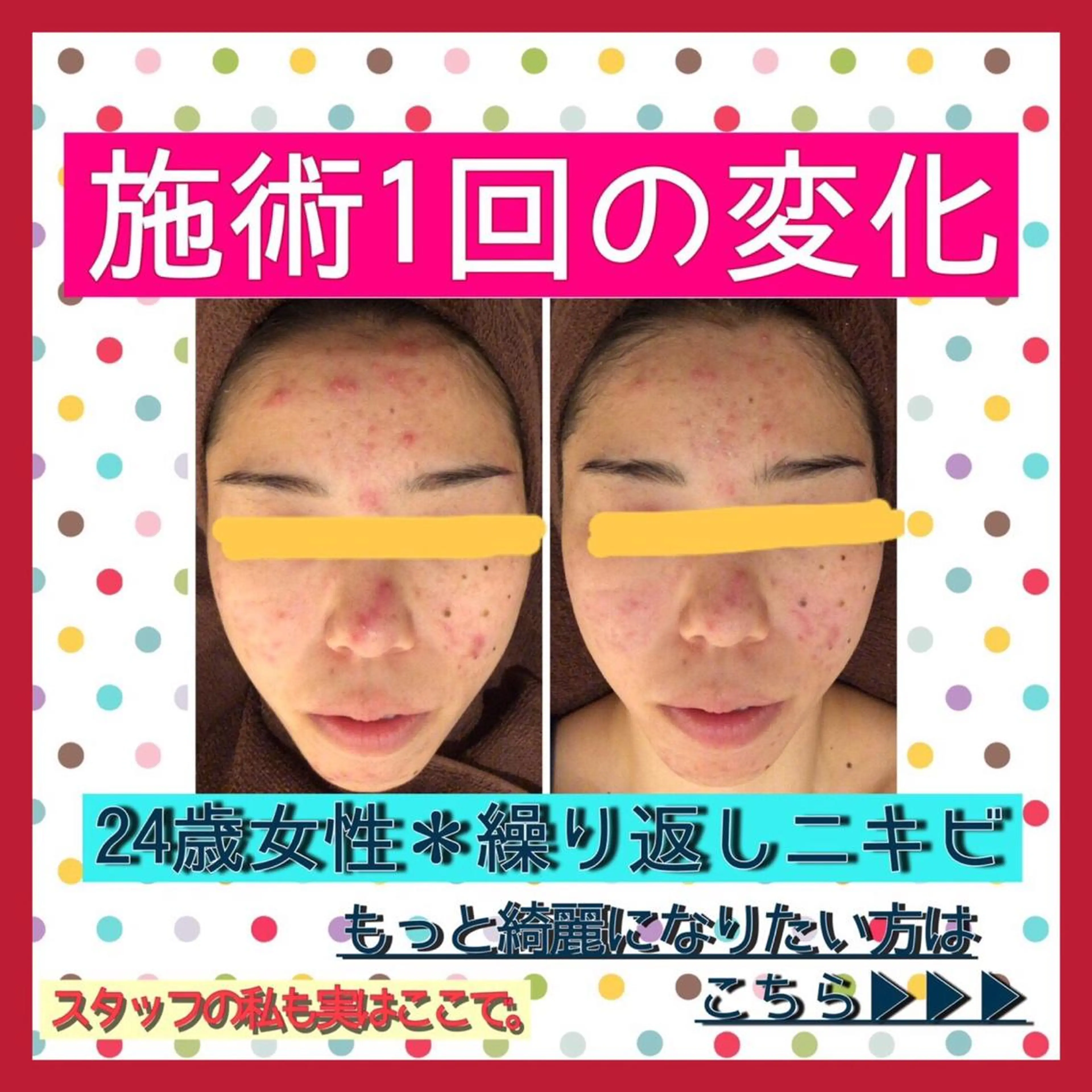 ショート カラー パーマ ヘアアレンジ メンズ キッズ ネイル マツエク・マツパ ニキビ・肌質改善専門 ♡人生が変わるサロンのエステ・リラクイメージ