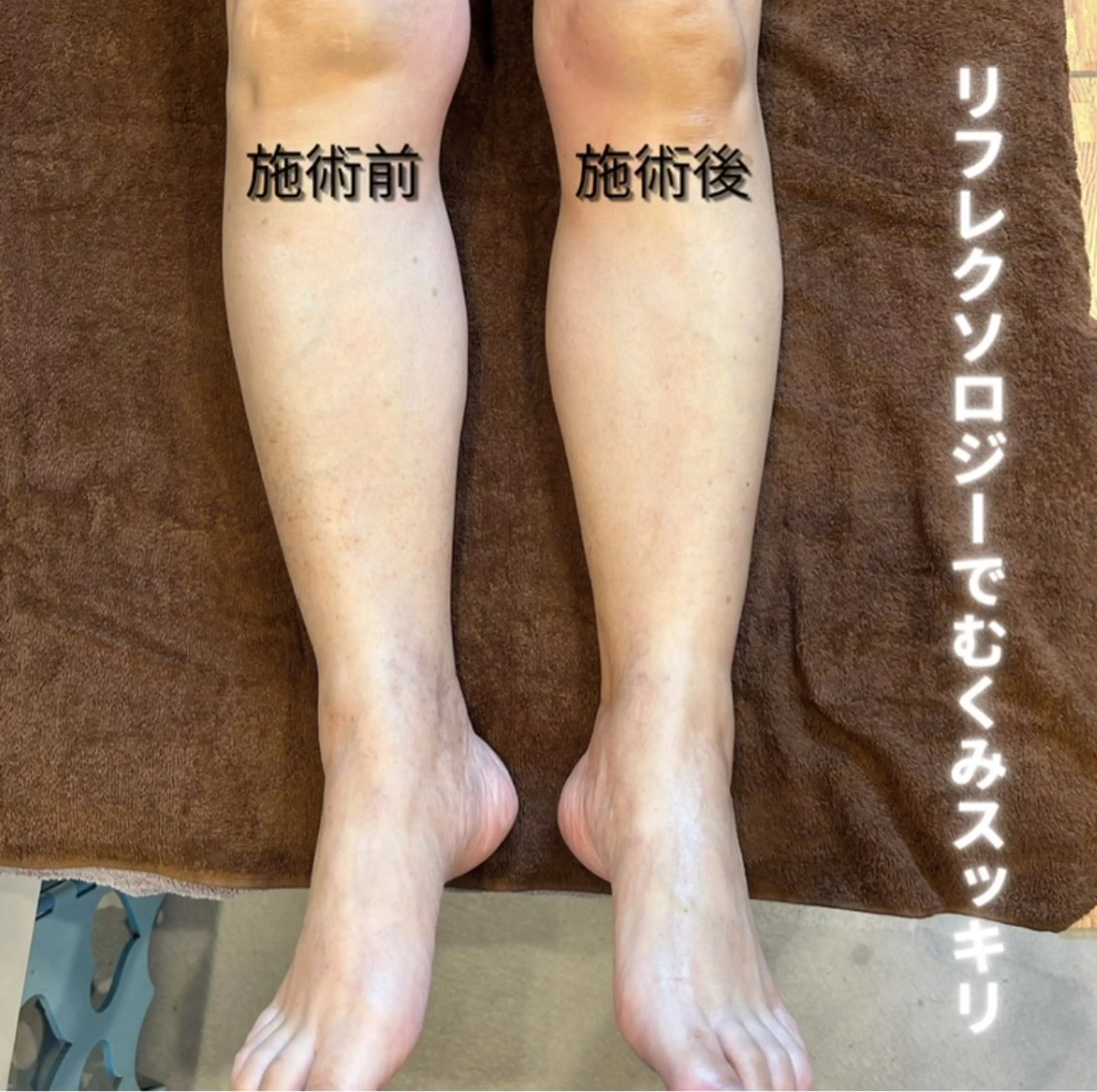 足リフレクソロジー(45分・フットバス付)の写真