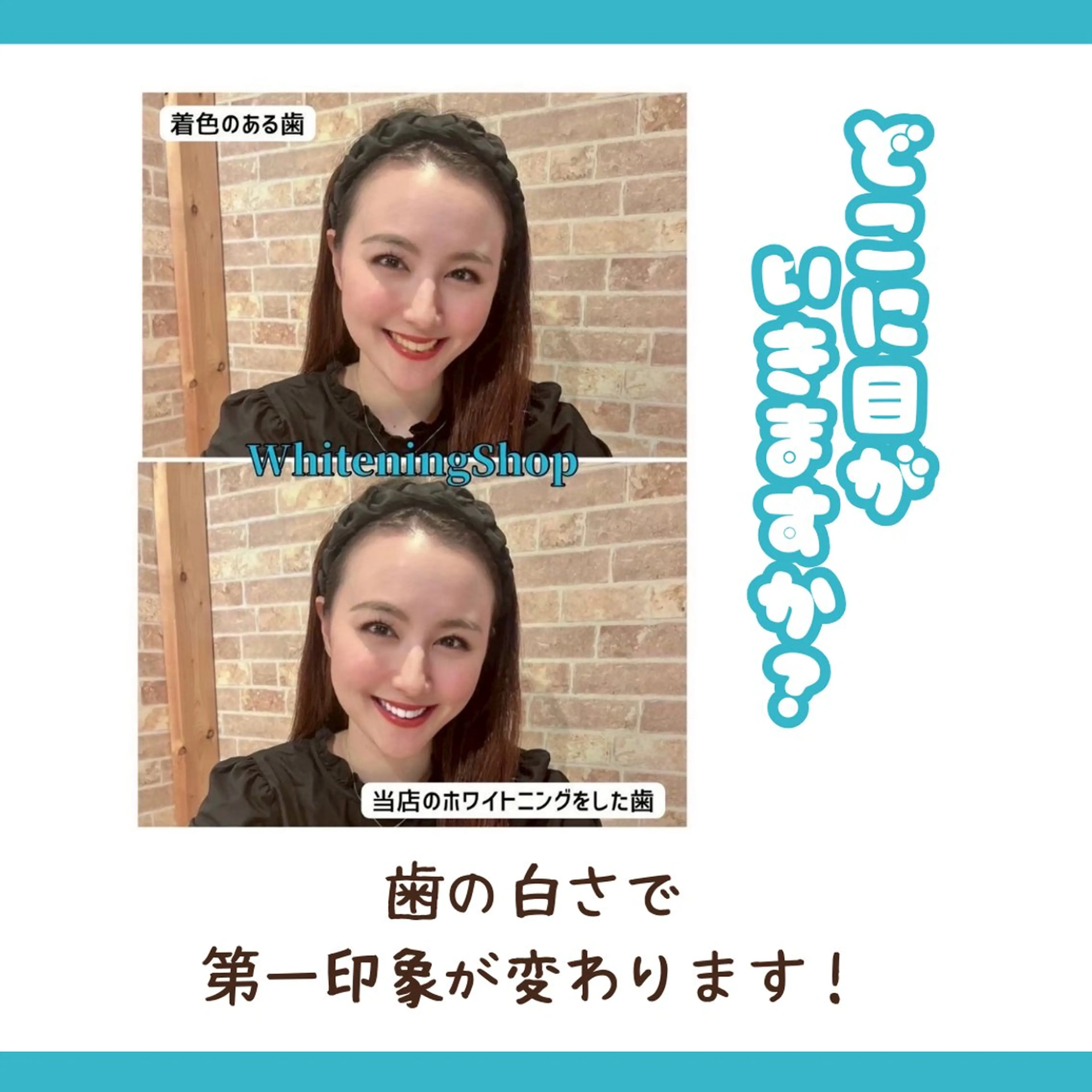 メンズ ホワイトニング ショップ多摩店のその他イメージ