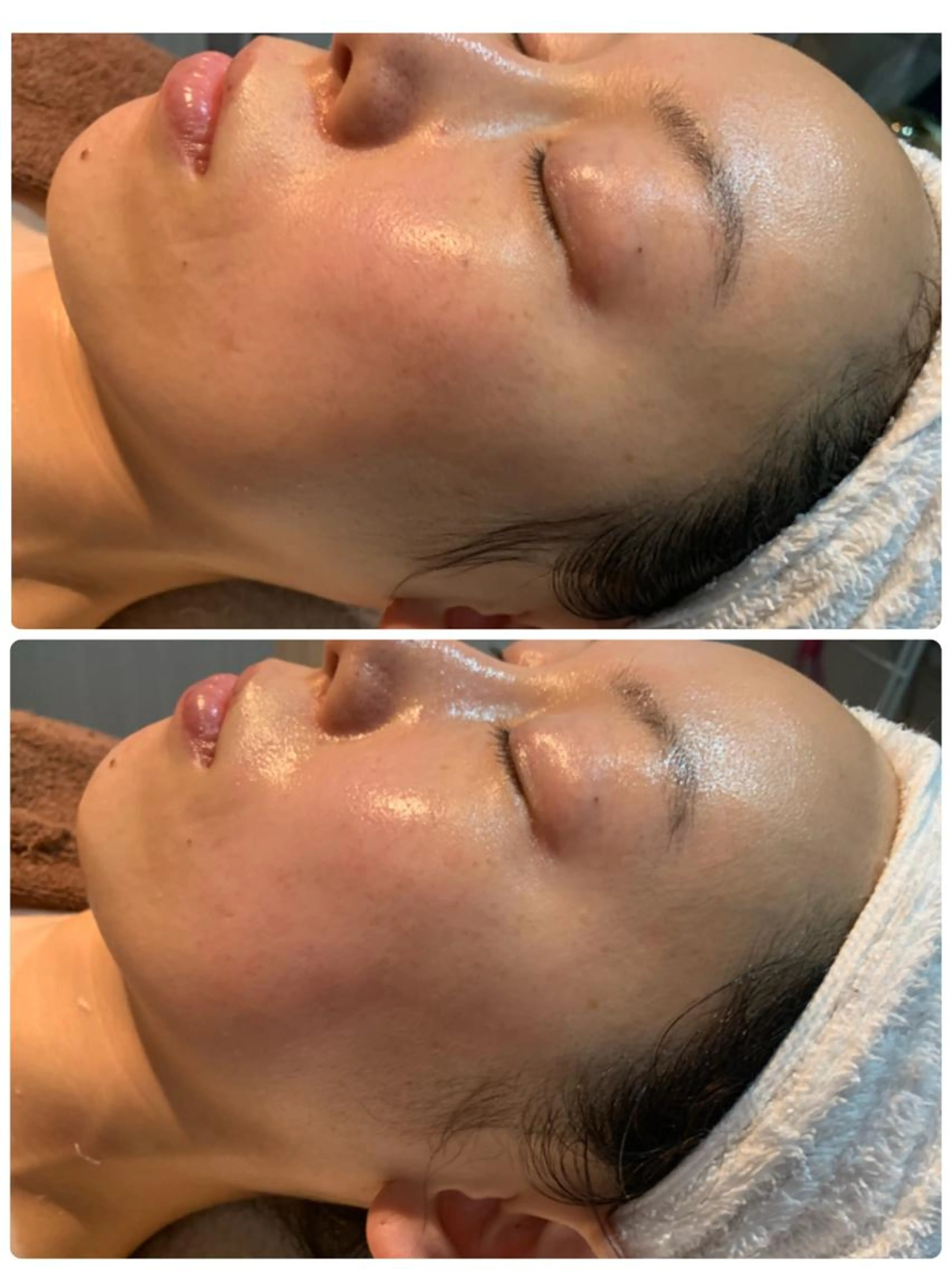 お顔のむくみ？お顔が大きくなったような😱という方。顔が四角になってきたような😱という方是非受けてみてください。の写真