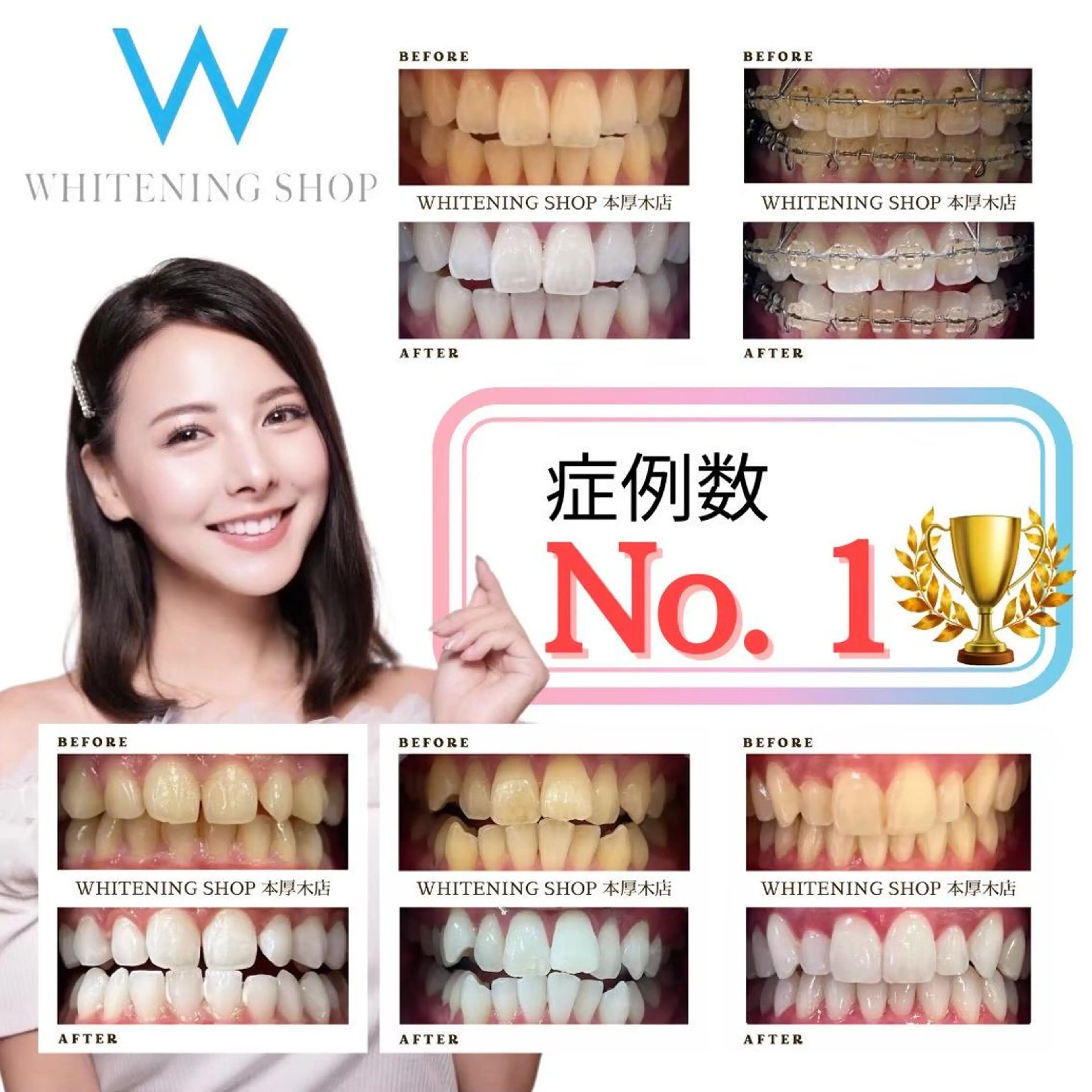 メンズ その他 ホワイトニング ショップ本厚木のその他イメージ