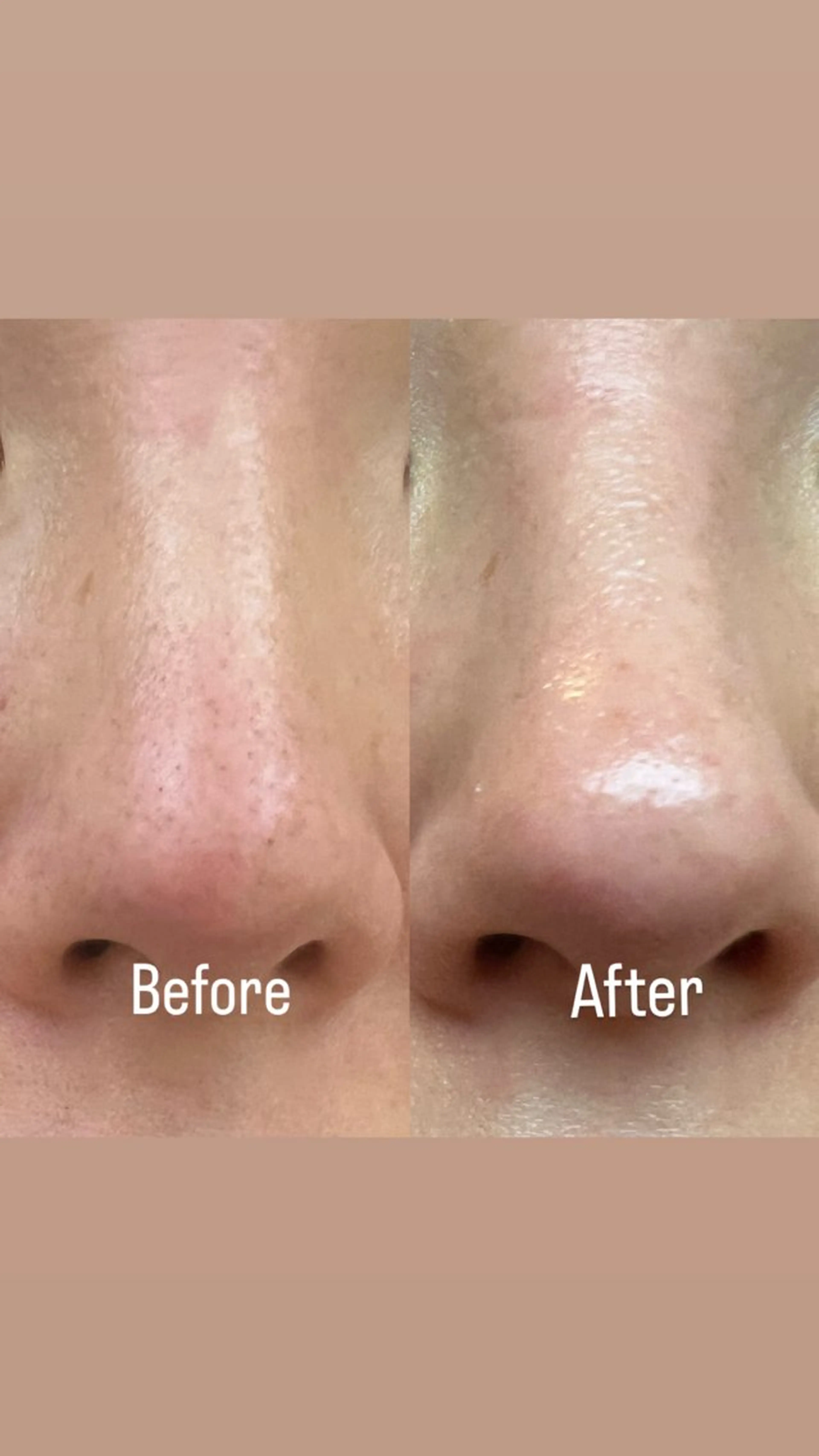 眉毛/美肌の専門店 Mily🍒ミウィの眉毛・アイブロウイメージ