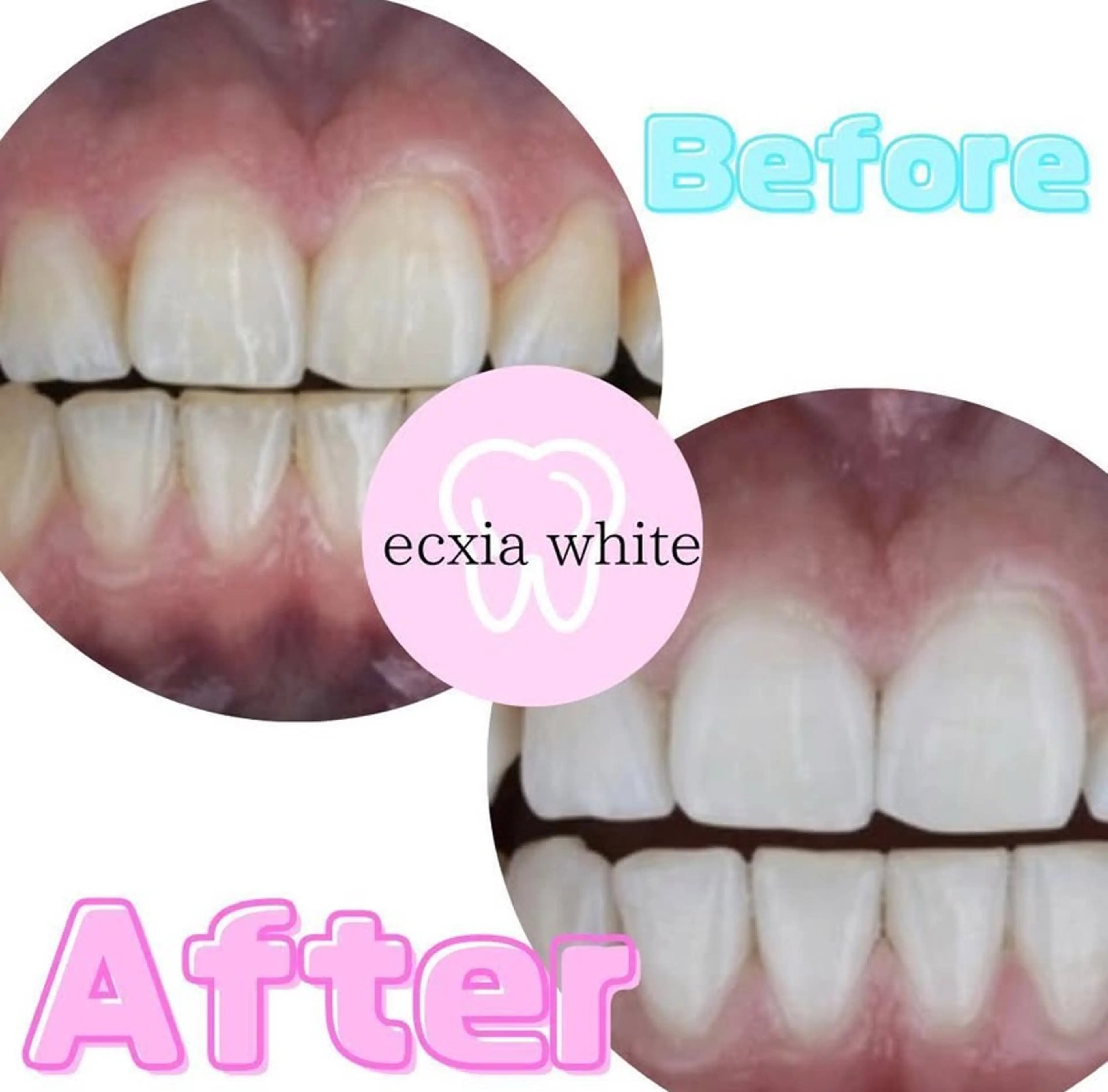 その他 nanami -ホワイトニングのその他イメージ