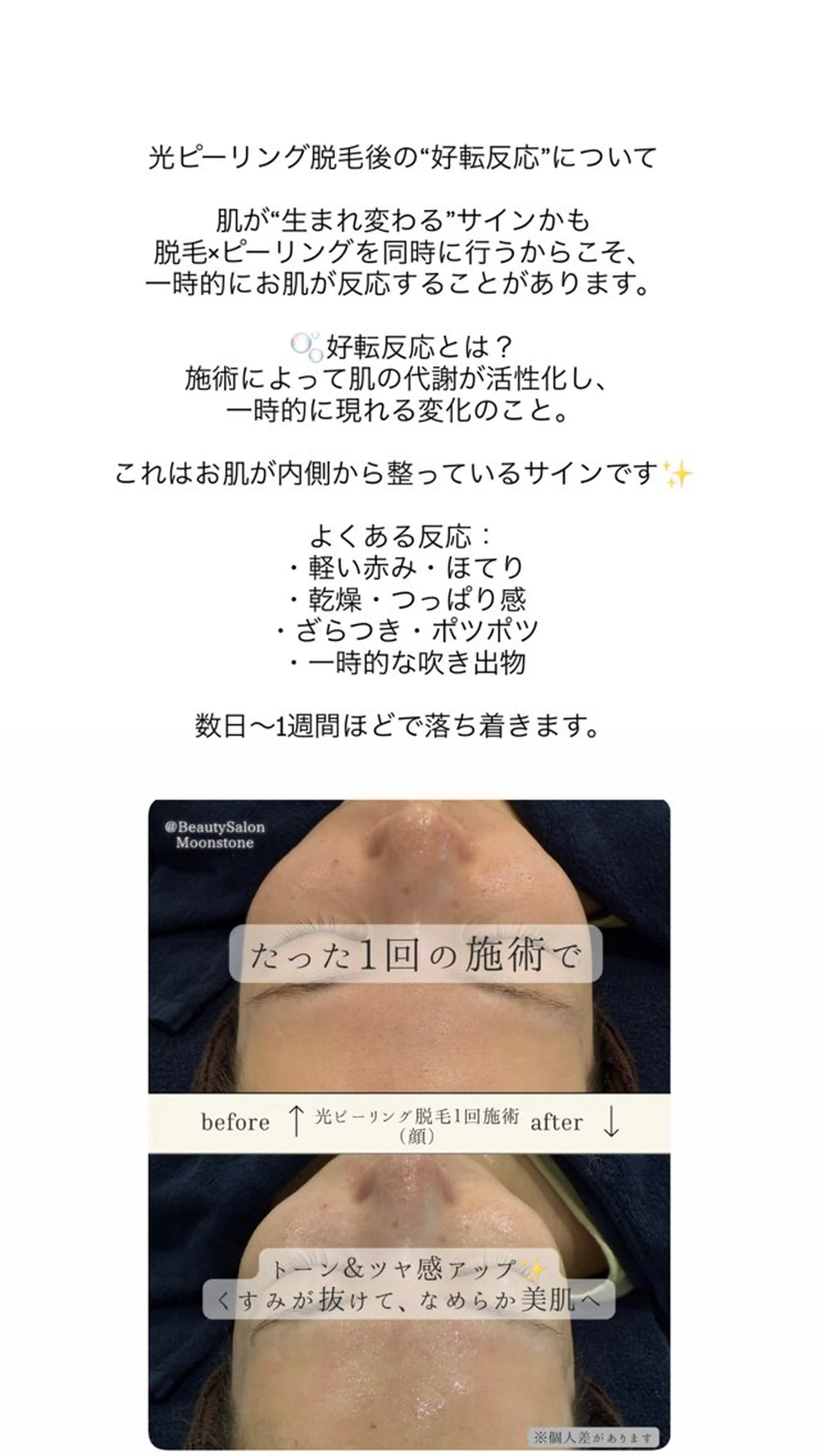 Moonstone 腸活ダイエット・脱毛のエステ・リラクイメージ