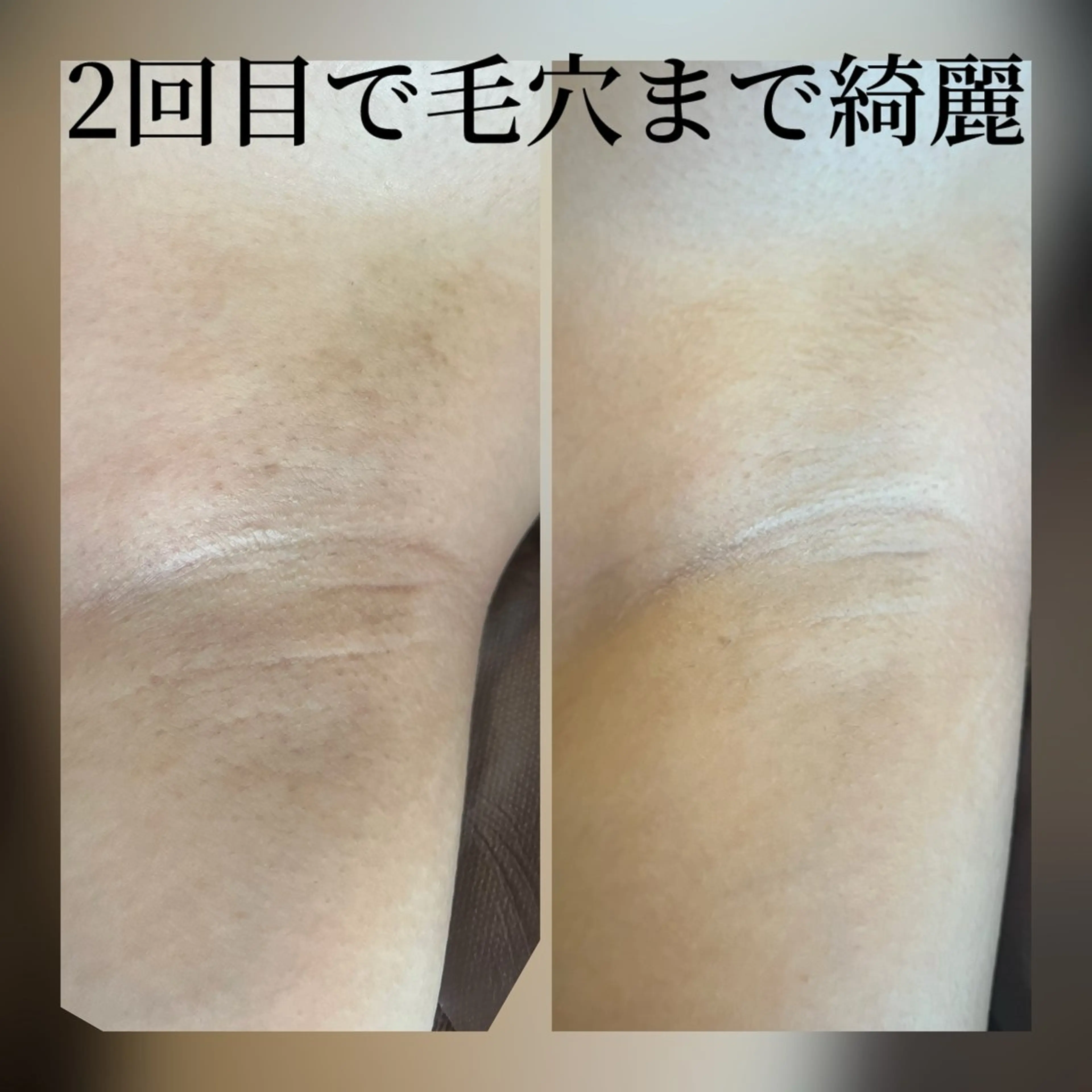 隠れ家サロン アクアガーデンのエステ・リラクイメージ