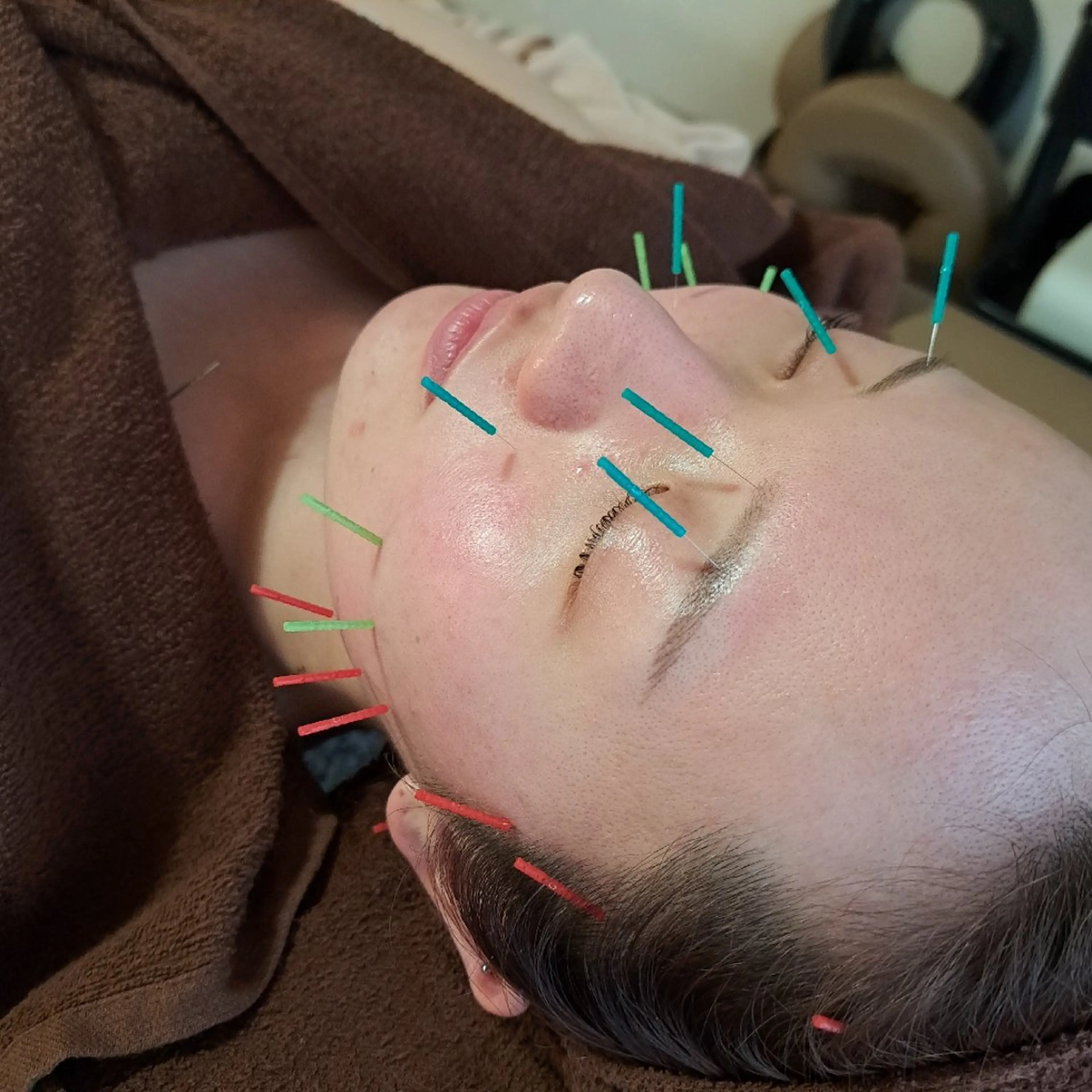 エステ リラク 鍼灸サロンmiyabi所属・美容鍼×エステ　鍼灸 サロンmiyabiのエステ・リラクイメージ