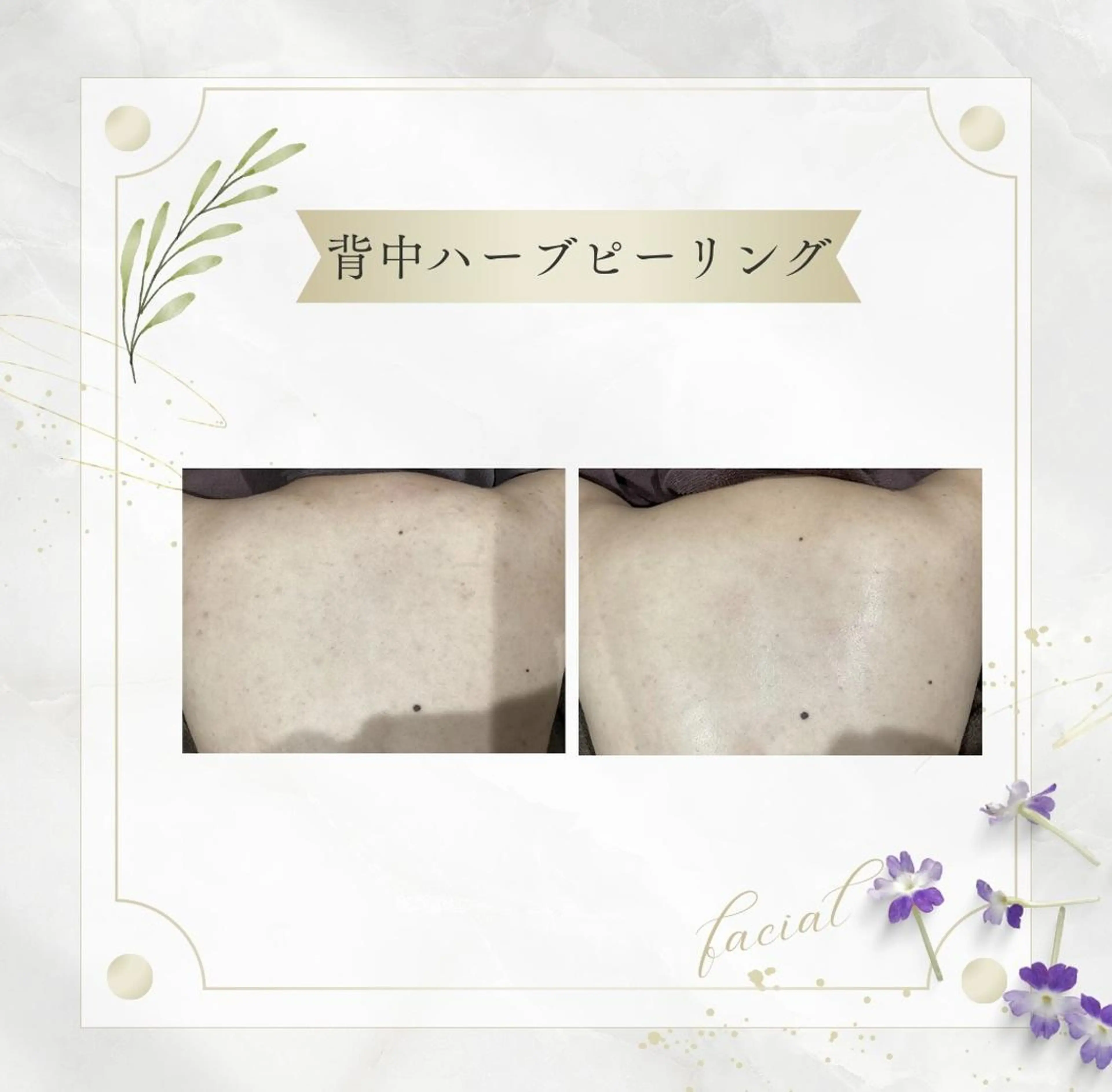 《 肌質×美肌 》 addissimoのエステ・リラクイメージ