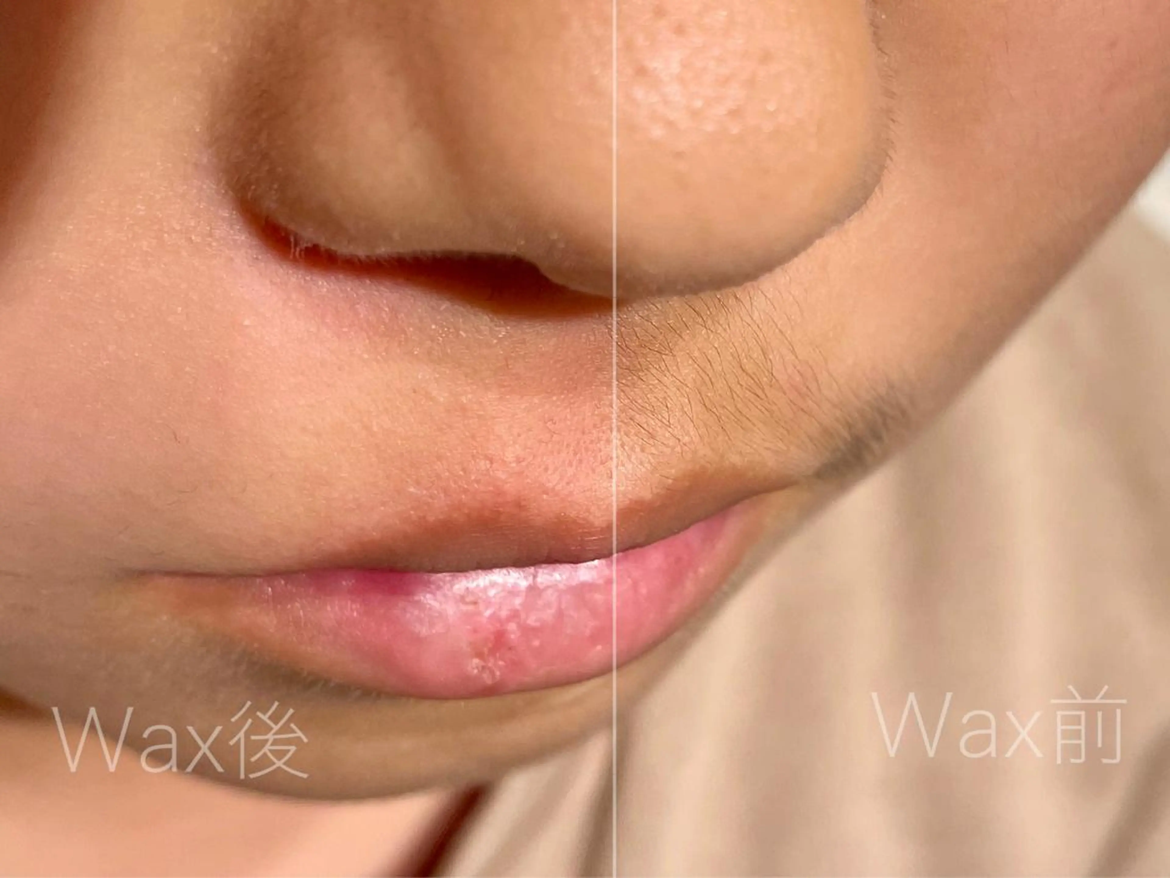 顔Wax🧴保湿パック付き/黒ずみ、角質、小鼻の角栓までとれてピカピカ艶肌に⭐️の写真