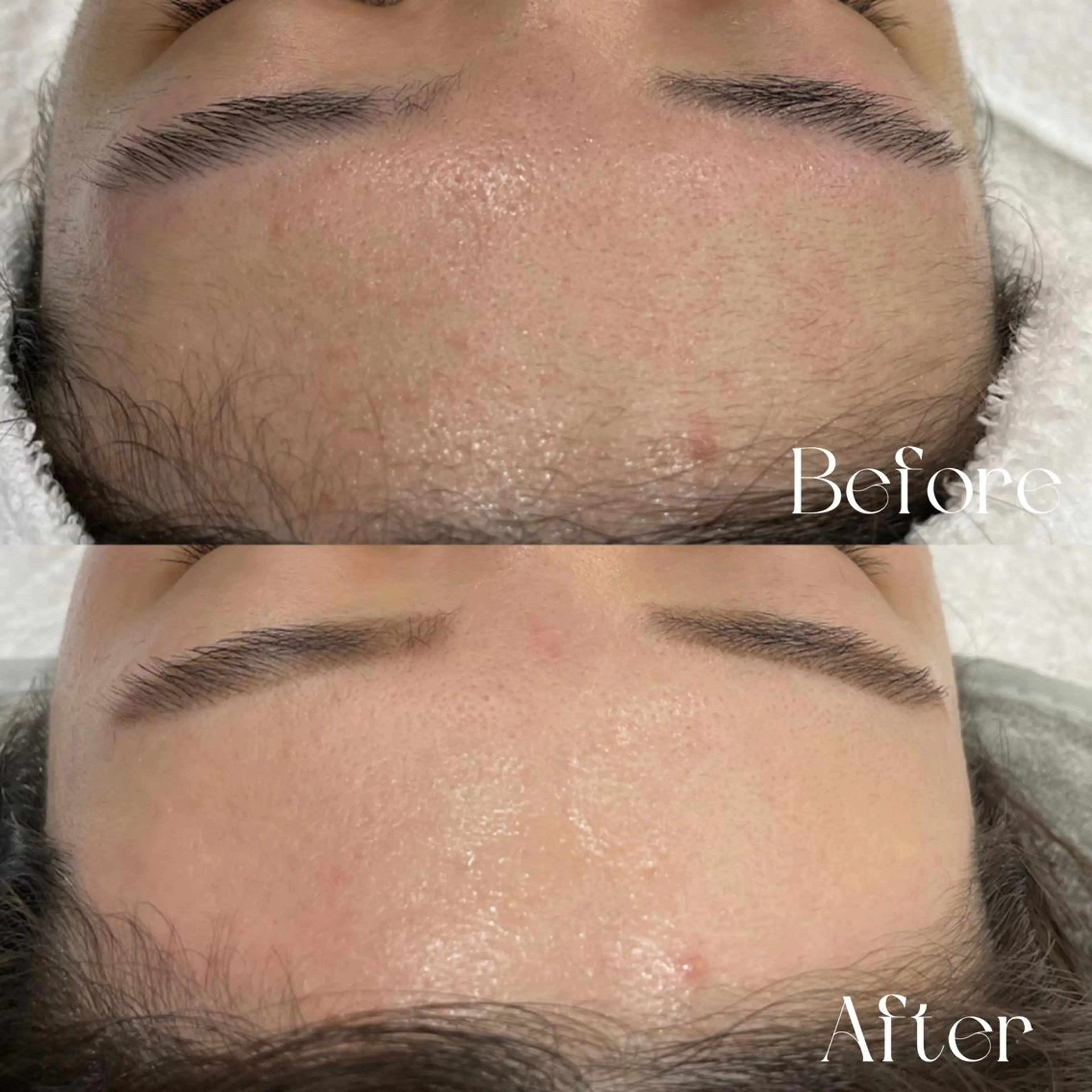 【🌻毛穴にお悩みの方へ🌻】美眉スタイリング＋フェイシャルワックス脱毛 WAXXXX ワックストリプルエックスの写真