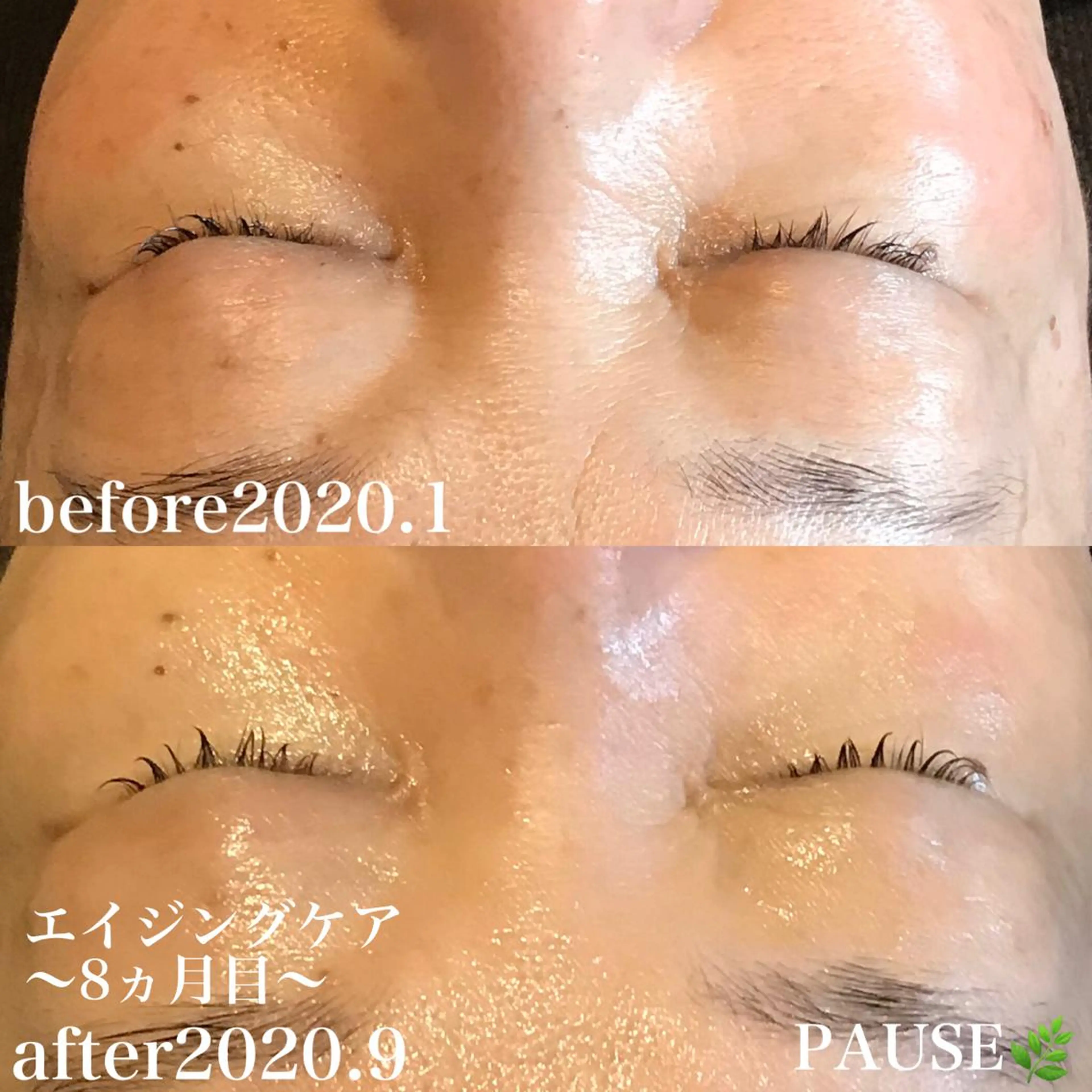 エステ 浜野 恵美のエステ・リラクイメージ