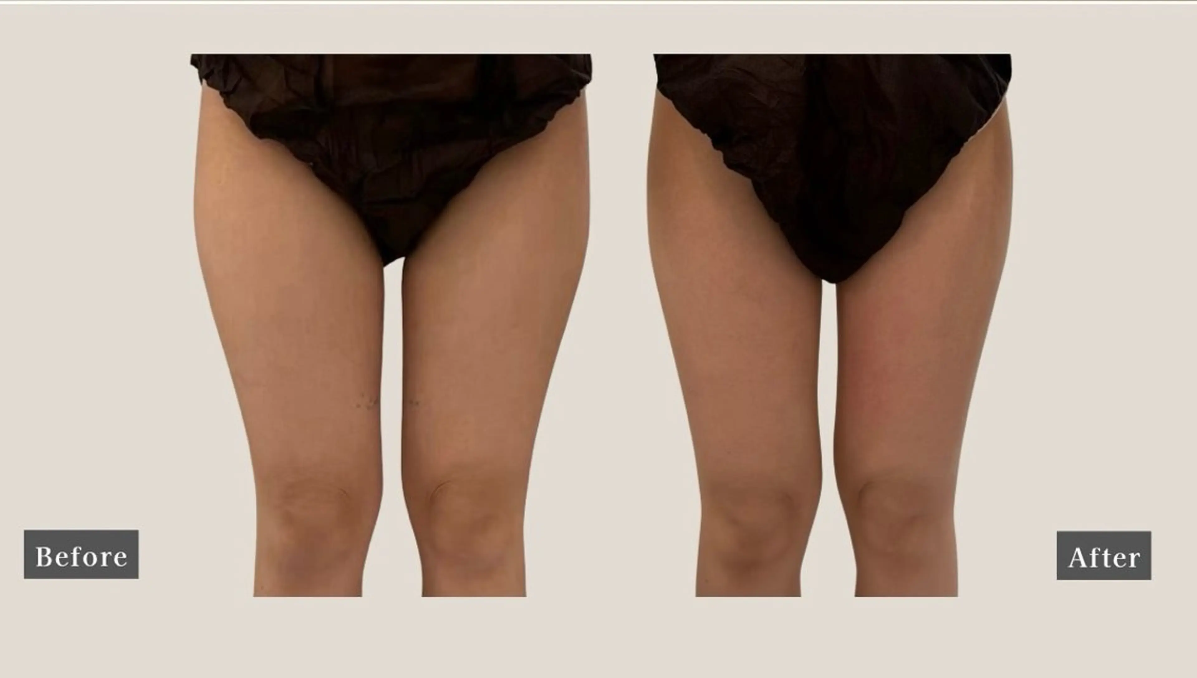 その他 NACHUL MANAのその他イメージ