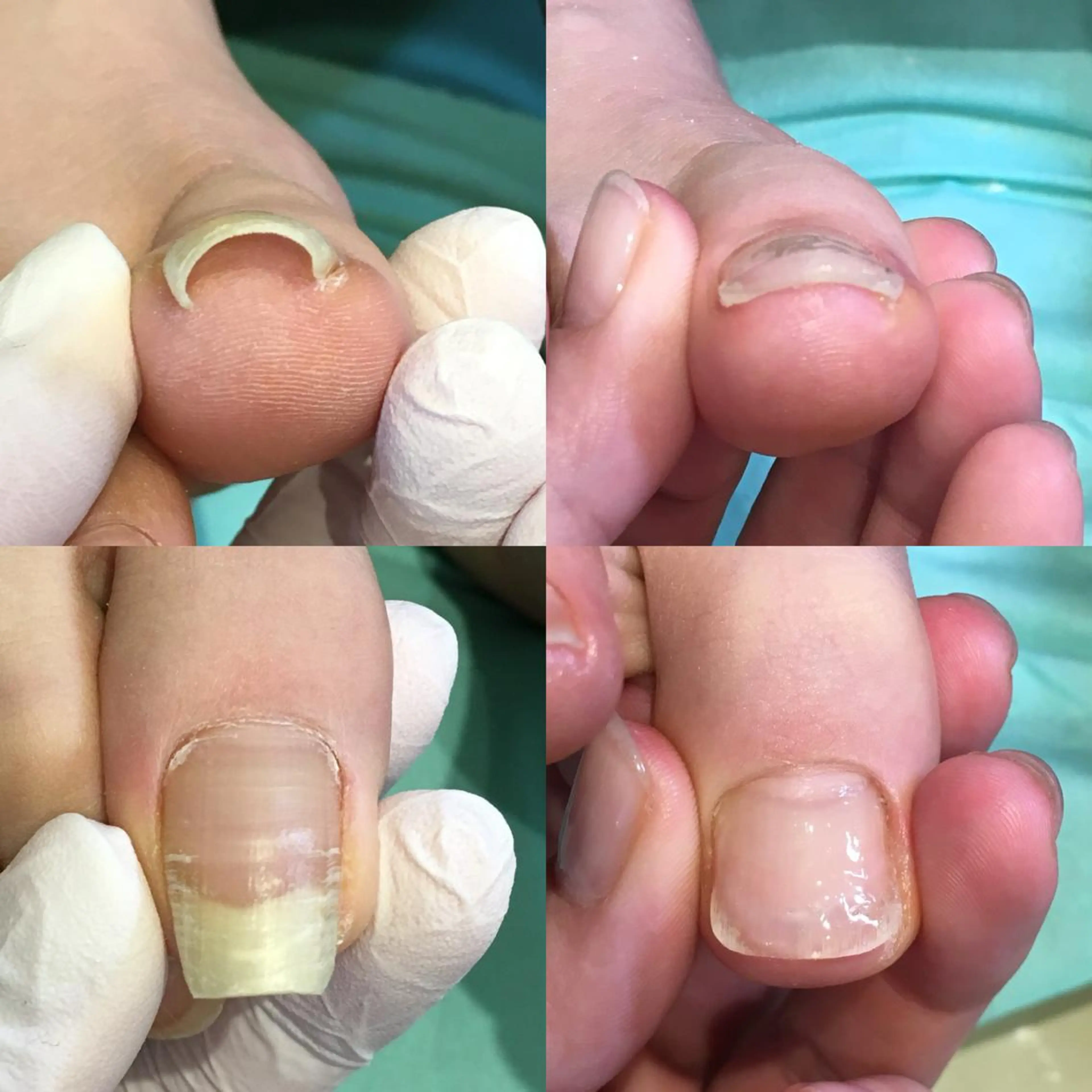 ネイル 東京巻き爪アカデミー所属・東京巻き爪 アカデミーのエステ・リラクイメージ