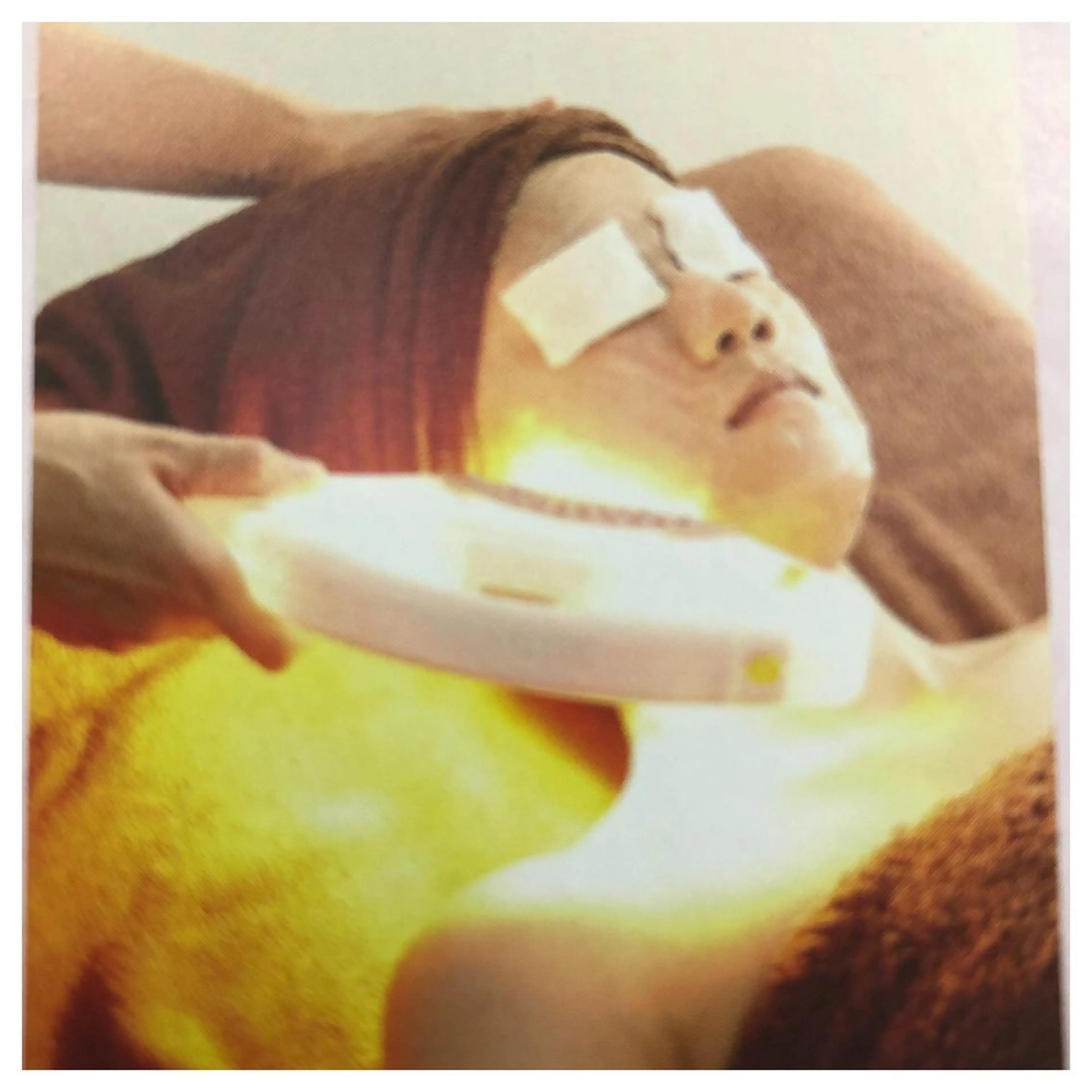 お肌を整えたい方必見👀シミ、シワ、たるみ、毛穴、ゆらぎ肌にも⭐︎BBL光フェイシャル☆の写真