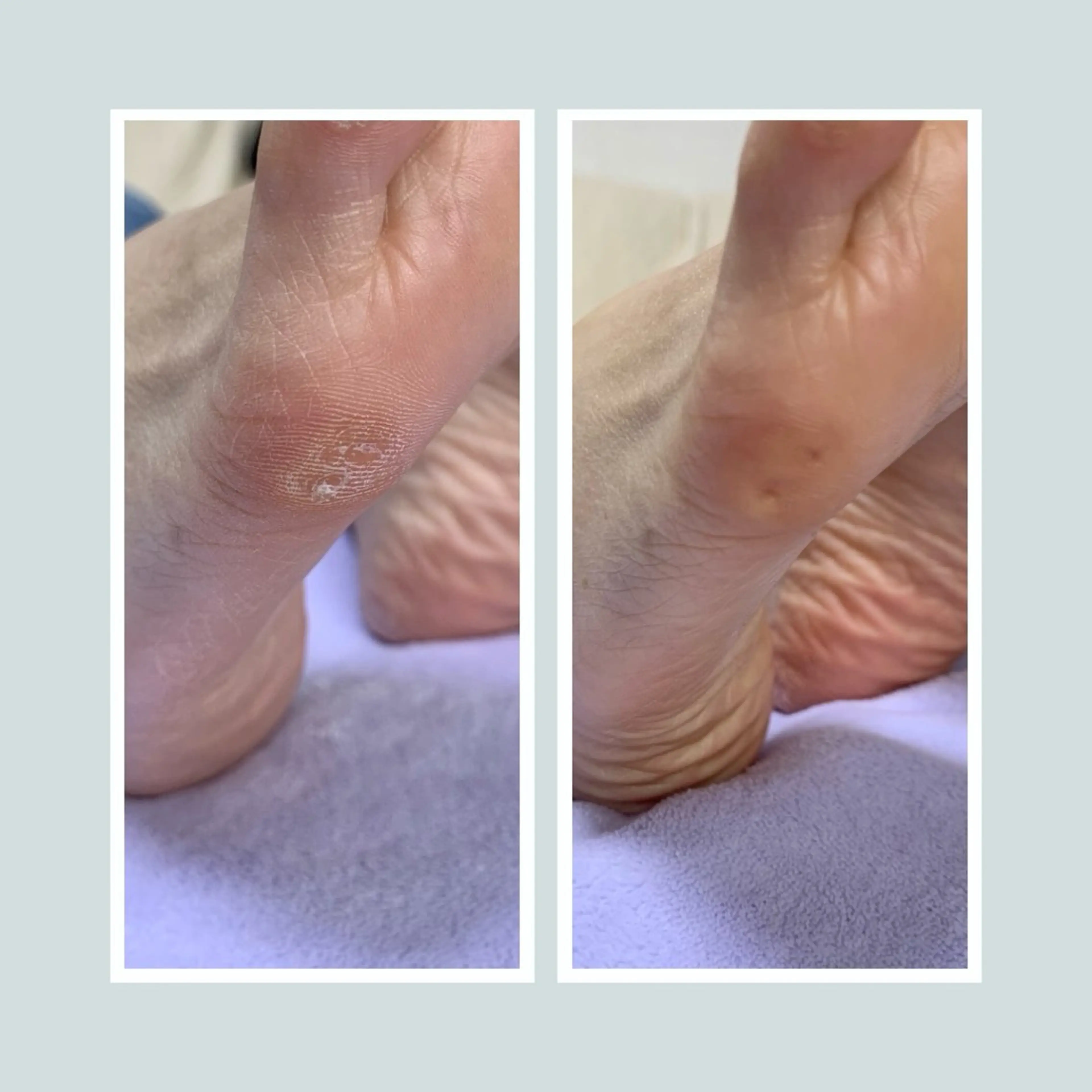 足トラブル専門 ニコルル金沢のエステ・リラクイメージ