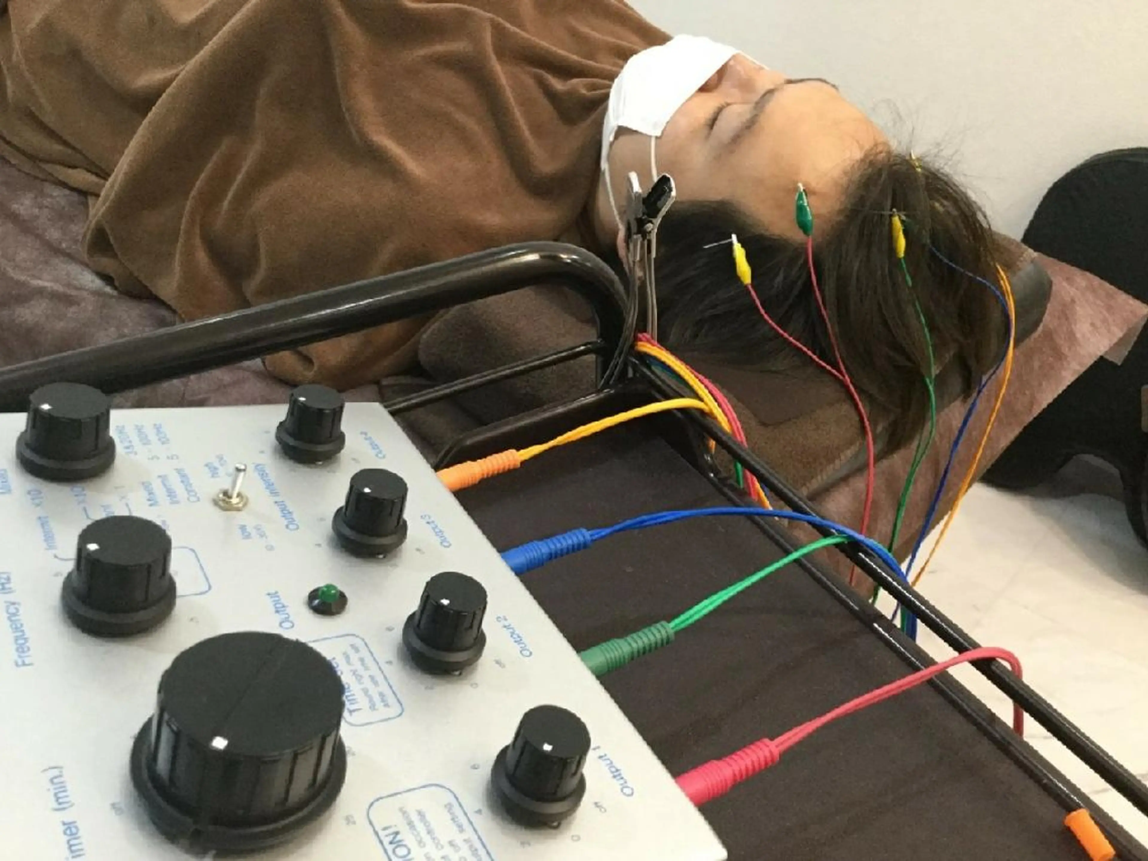 美髪・増毛鍼灸コースの写真