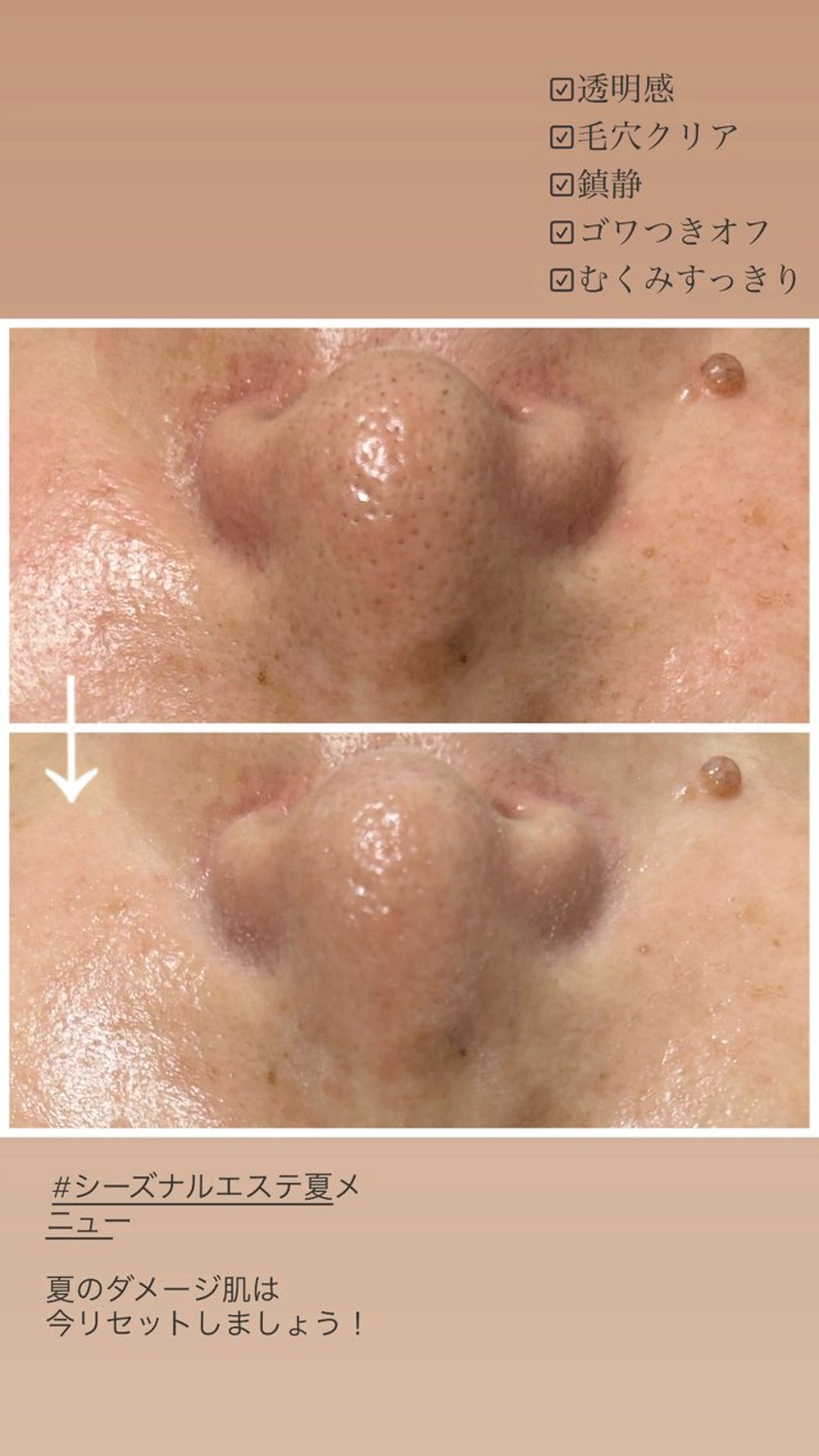 デアイム高島平所属・兼松 美香のエステ・リラクイメージ