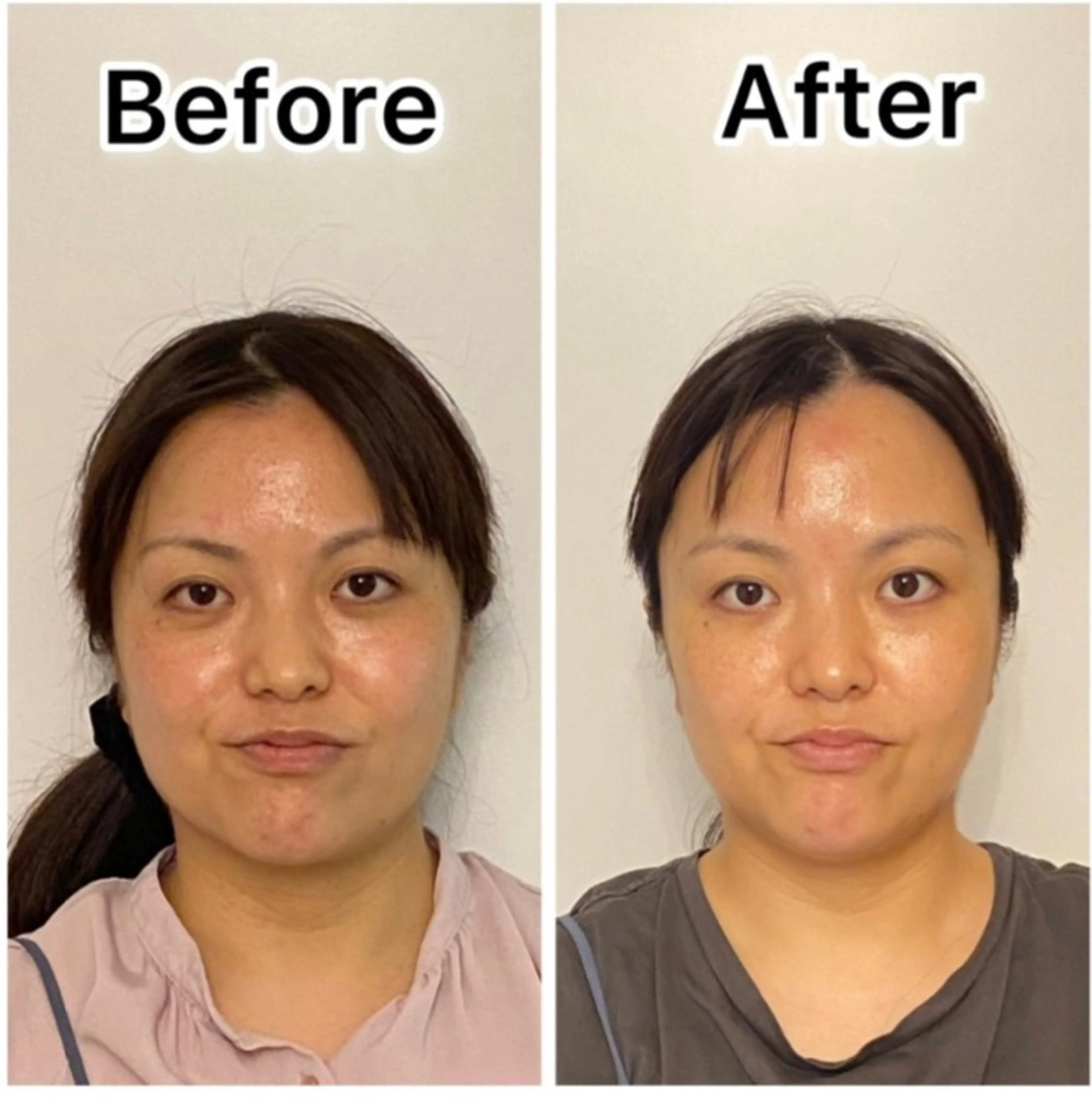 エステ ポテンツァ&針美容 バストアップ専門店のエステ・リラクイメージ