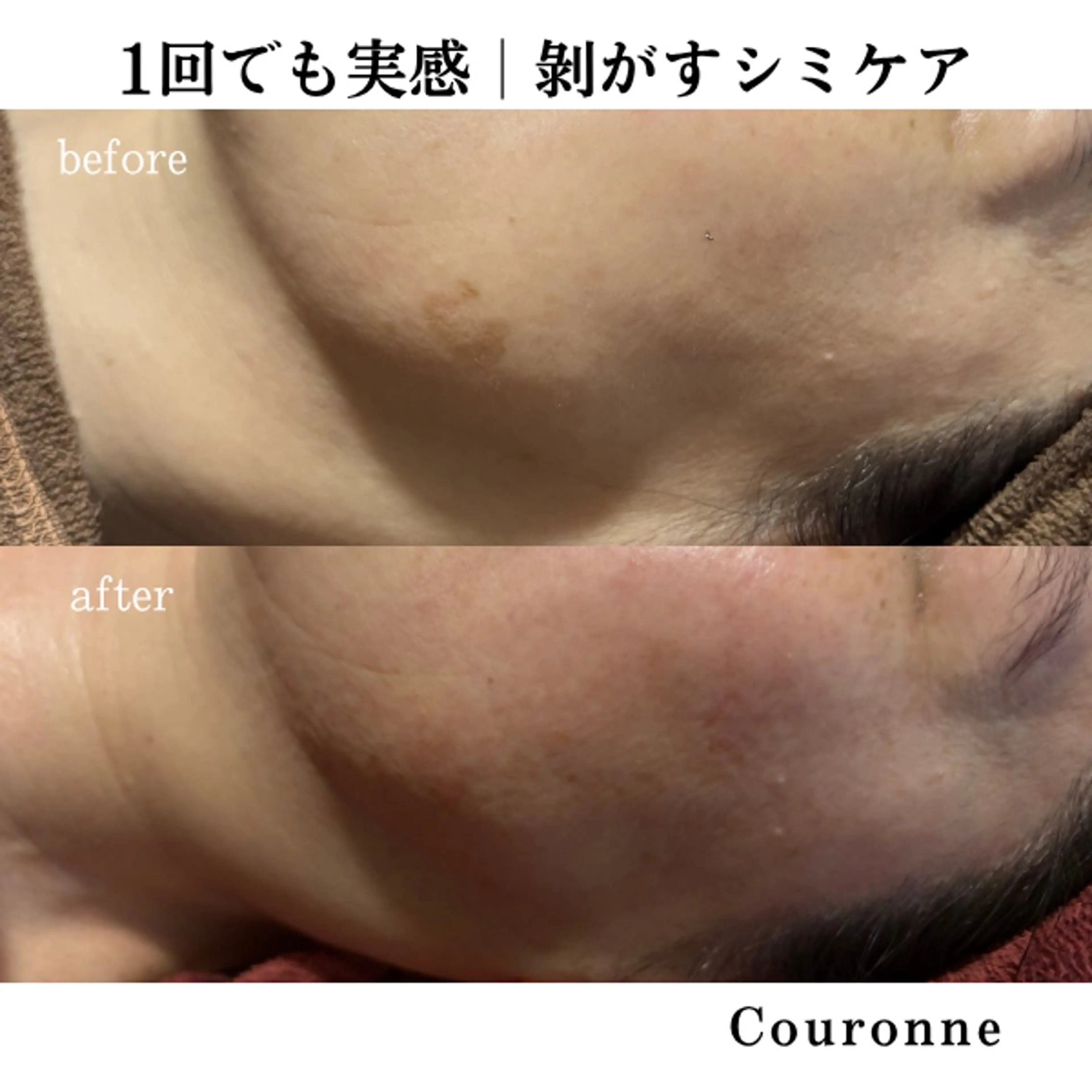 エステ シミ・毛穴ケア専門 クロヌYUKIのエステ・リラクイメージ