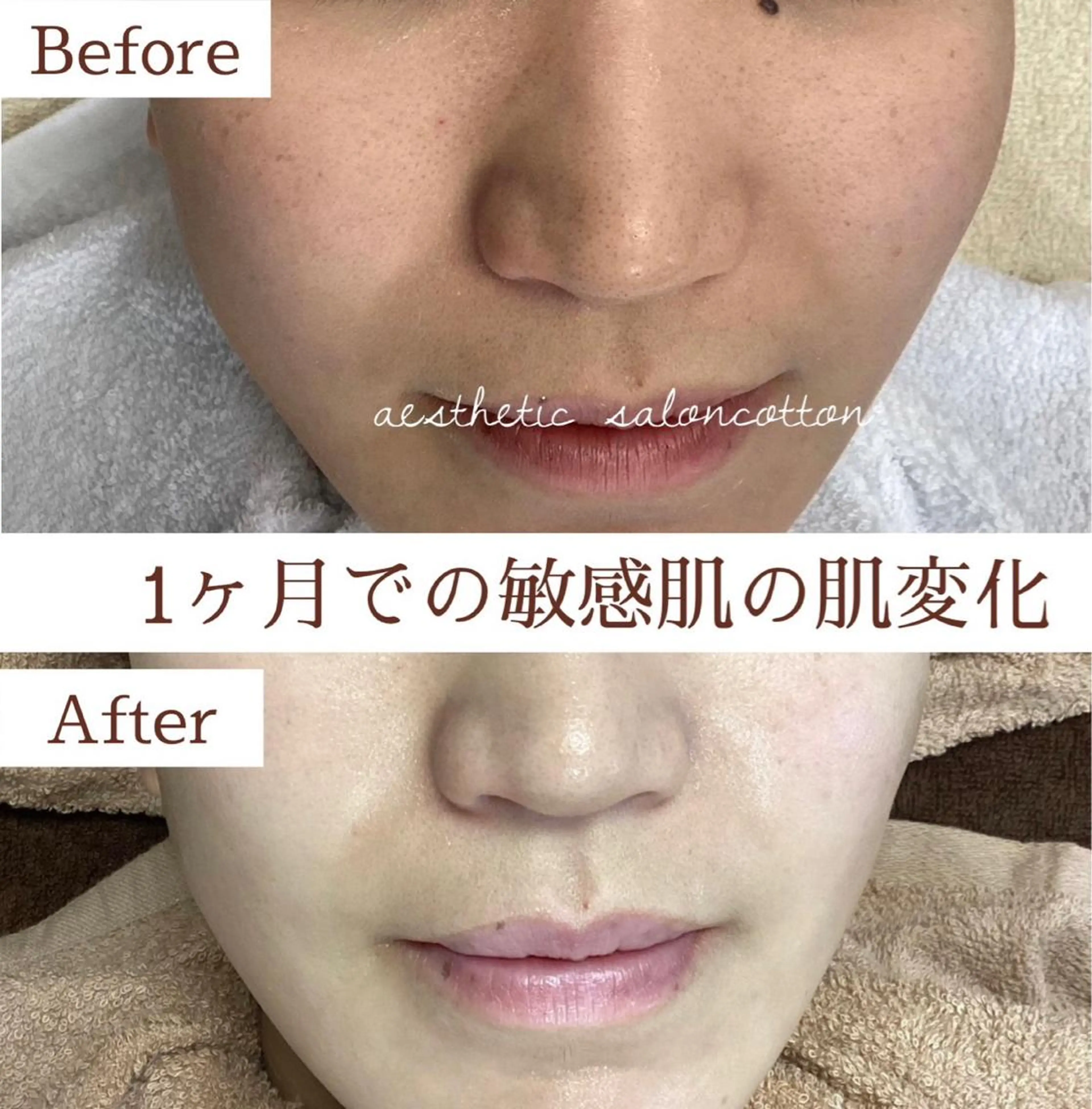 エステ 都度払い 肌質改善専門サロンのエステ・リラクイメージ