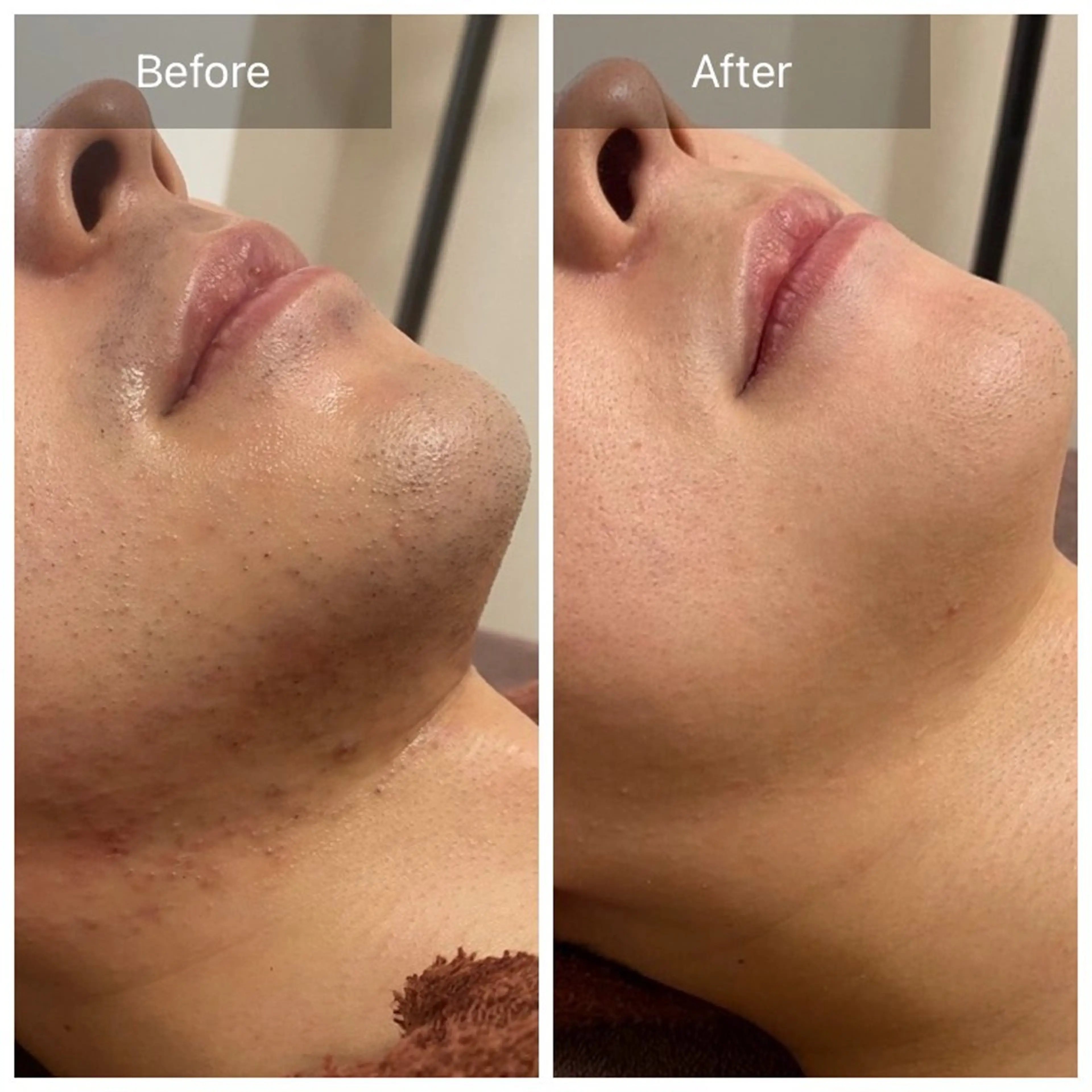 メンズ 脱毛 Beauty  Studio CARO所属・ビューティースタジオ カーロのその他イメージ