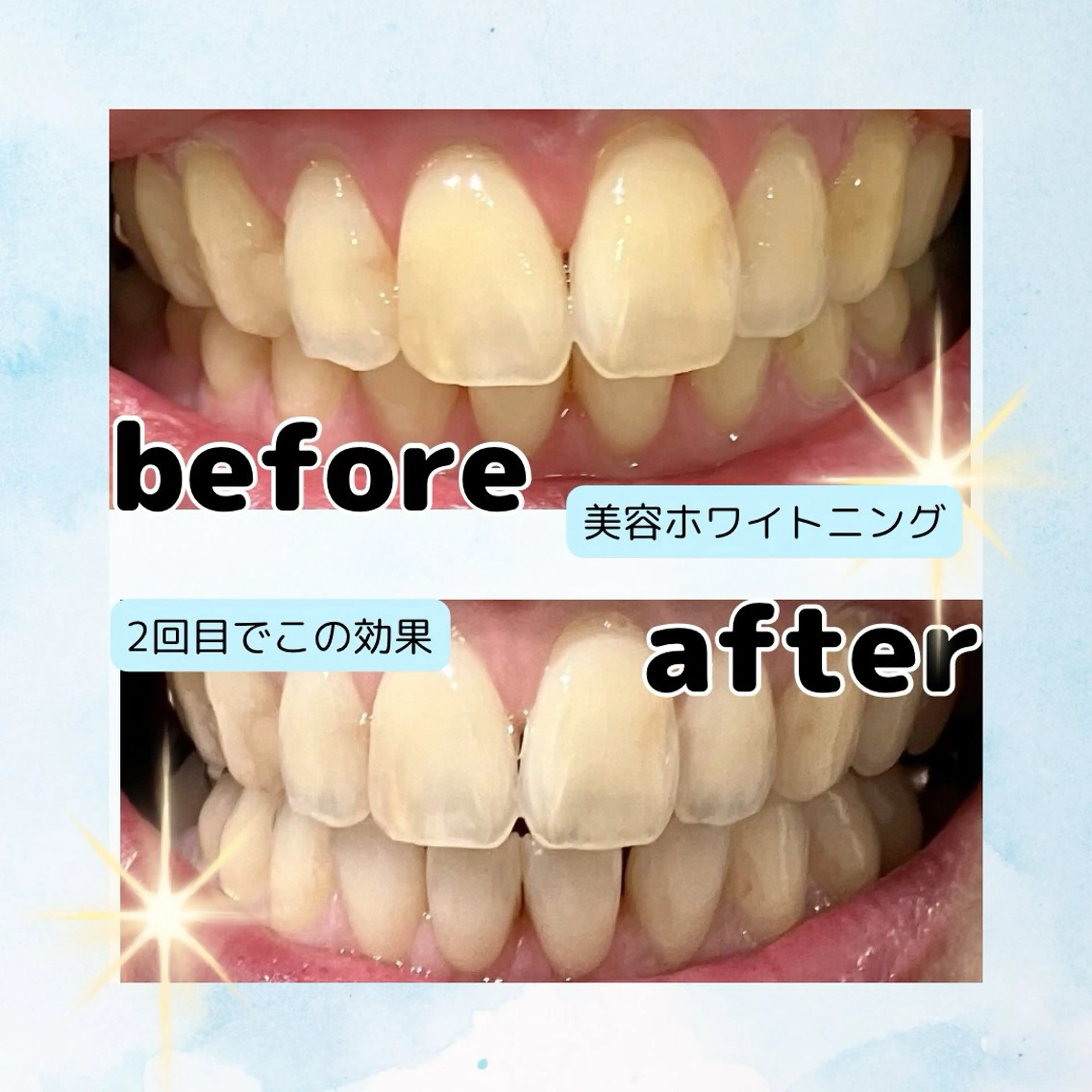 ホワイトニングサロン Soleilのその他イメージ