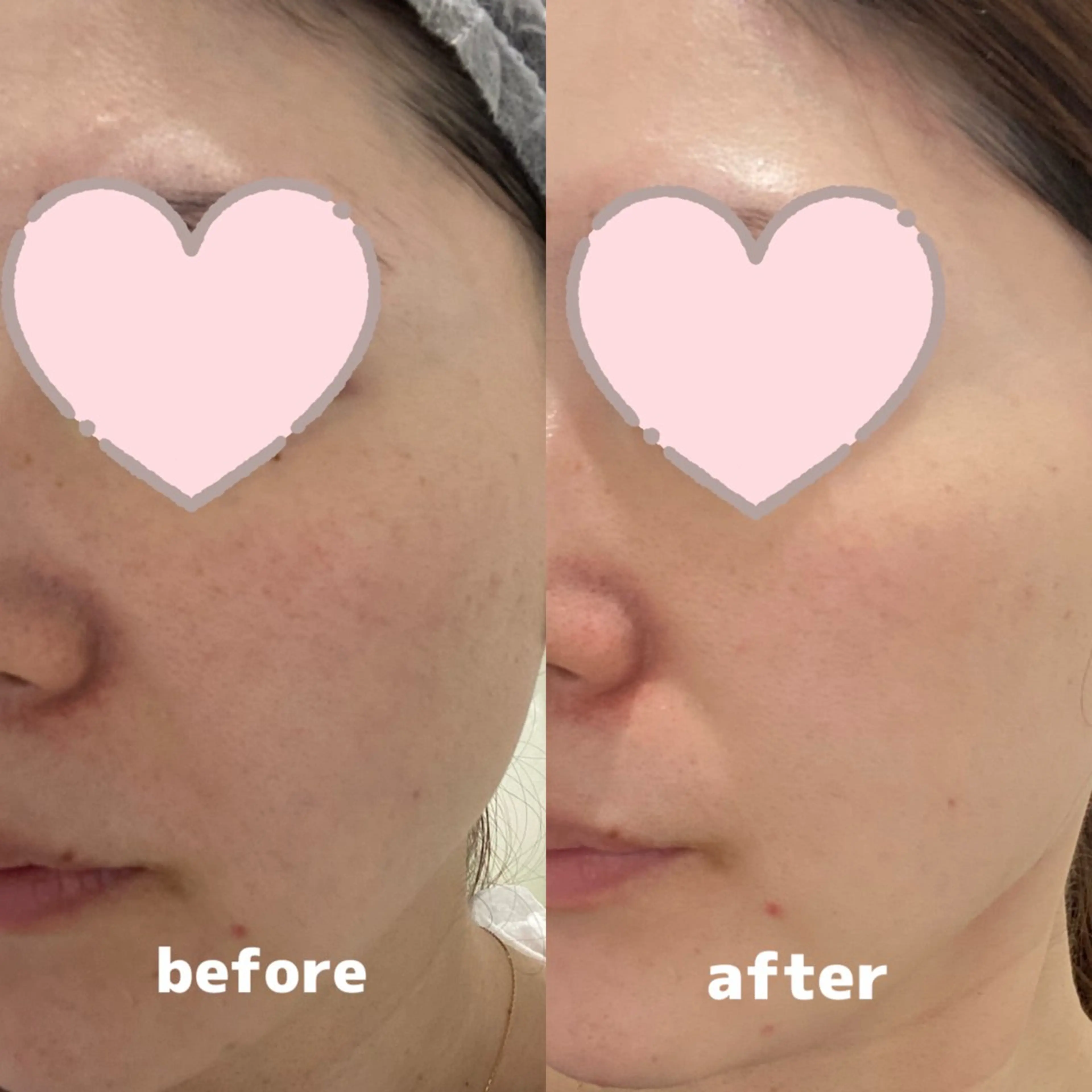 Whitening Beauty 行橋店のその他イメージ
