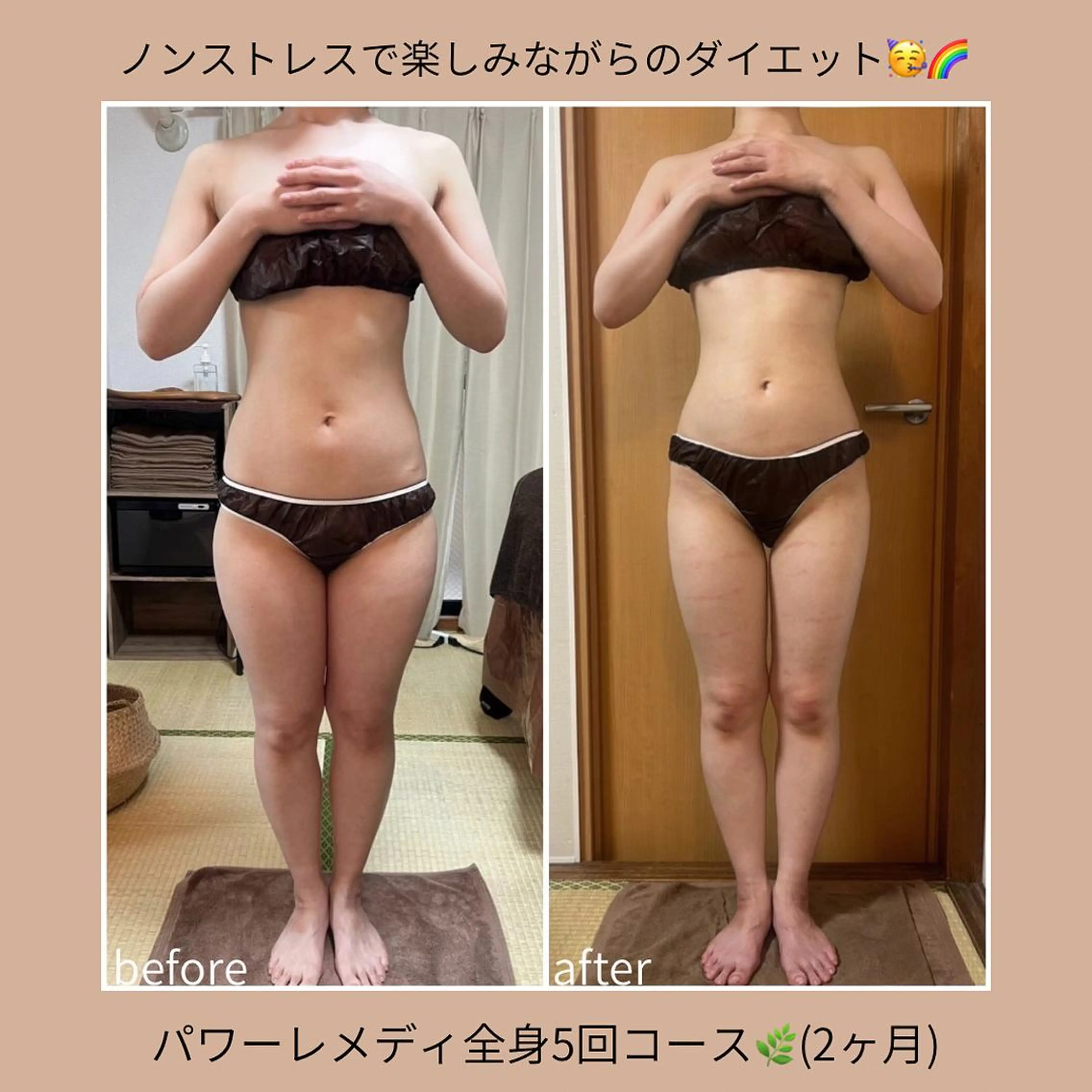 《本気痩せ×疲労改善 》  BILOOPのエステ・リラクイメージ