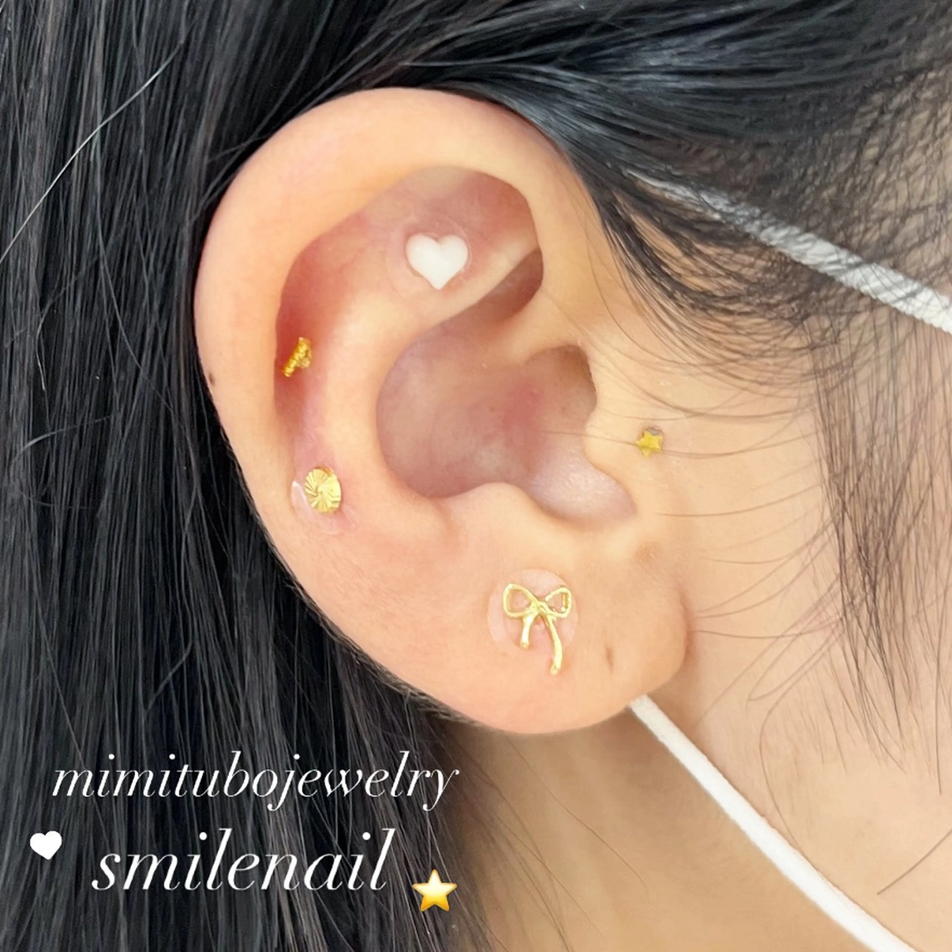 その他 smileskin 京都/meguのその他イメージ