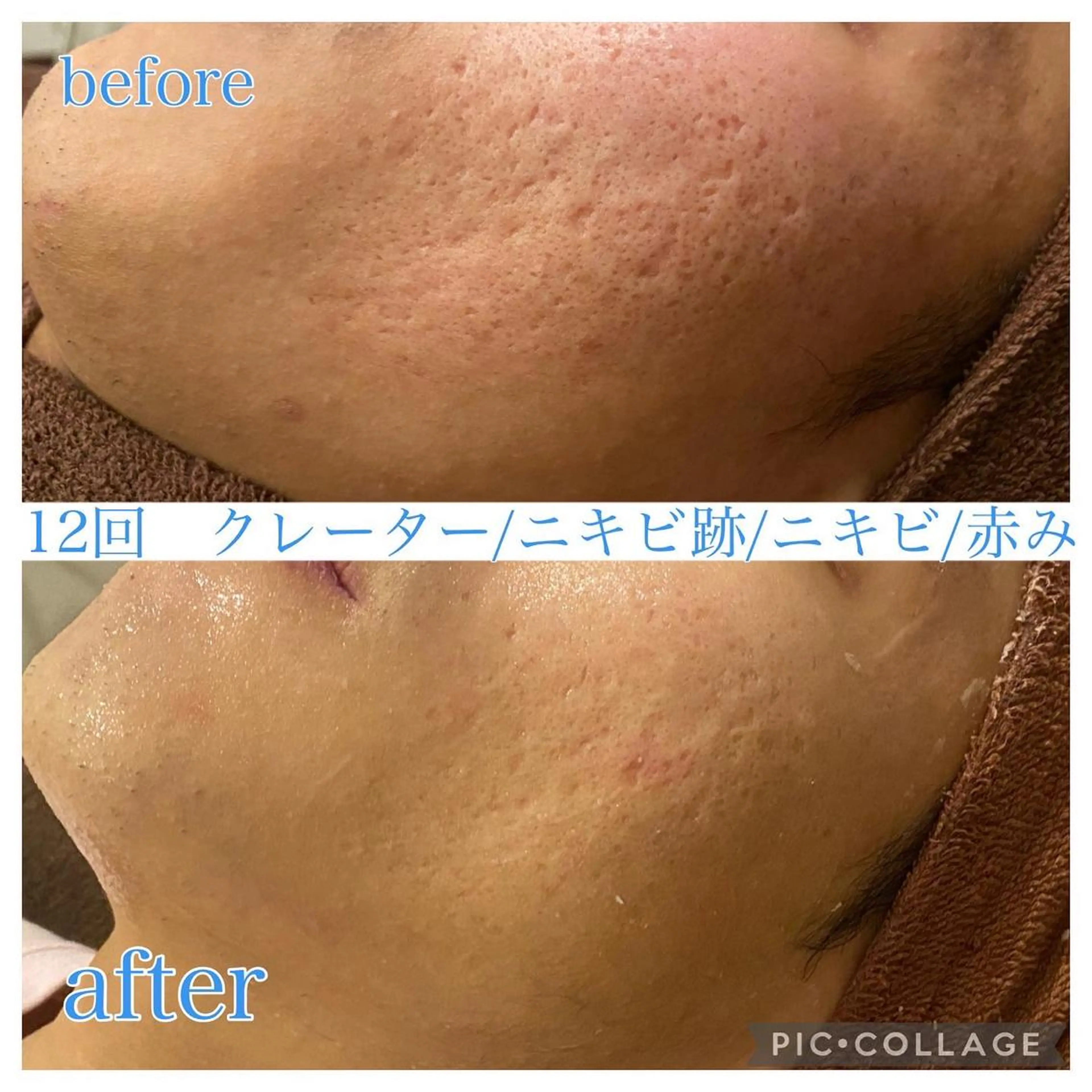 ショート カラー パーマ ヘアアレンジ メンズ ネイル マツエク・マツパ エステ リラク Ensor Clair所属・EnsorClair 代表　野口真央のエステ・リラクイメージ