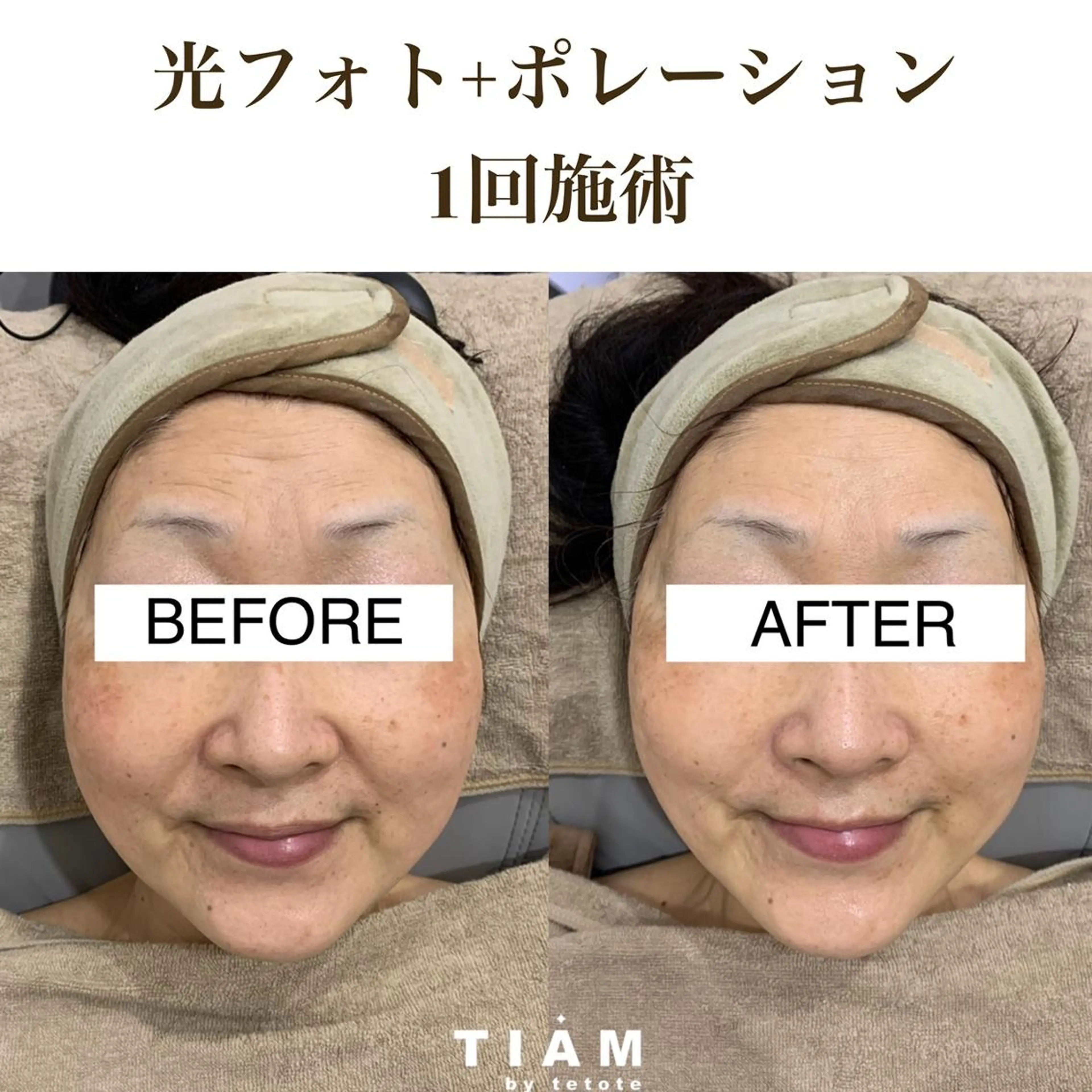 エステ 美肌サロンTIAM by tetoteのエステ・リラクイメージ