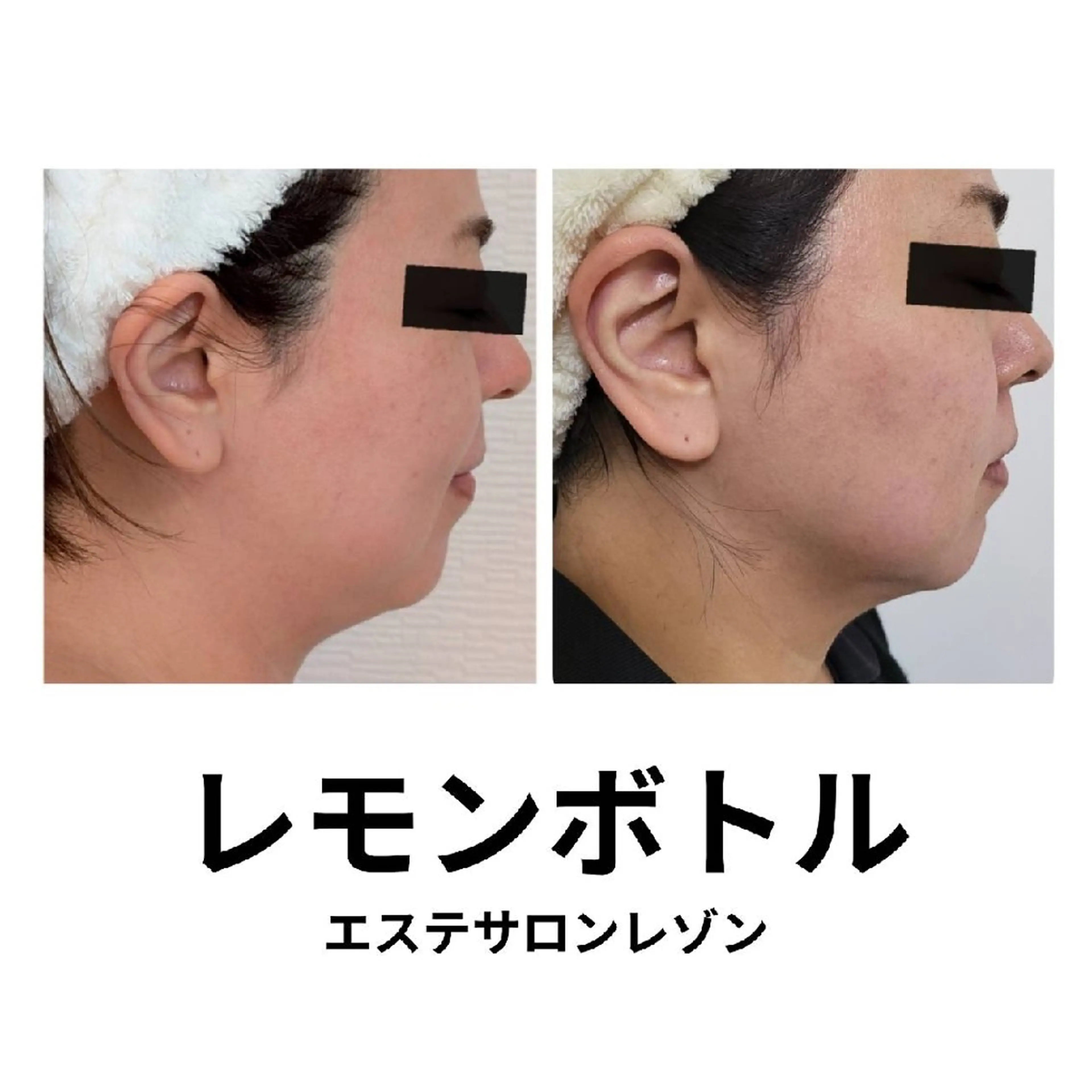 〈ニキビケアサロン〉 レゾン京橋店/ 浅川のエステ・リラクイメージ