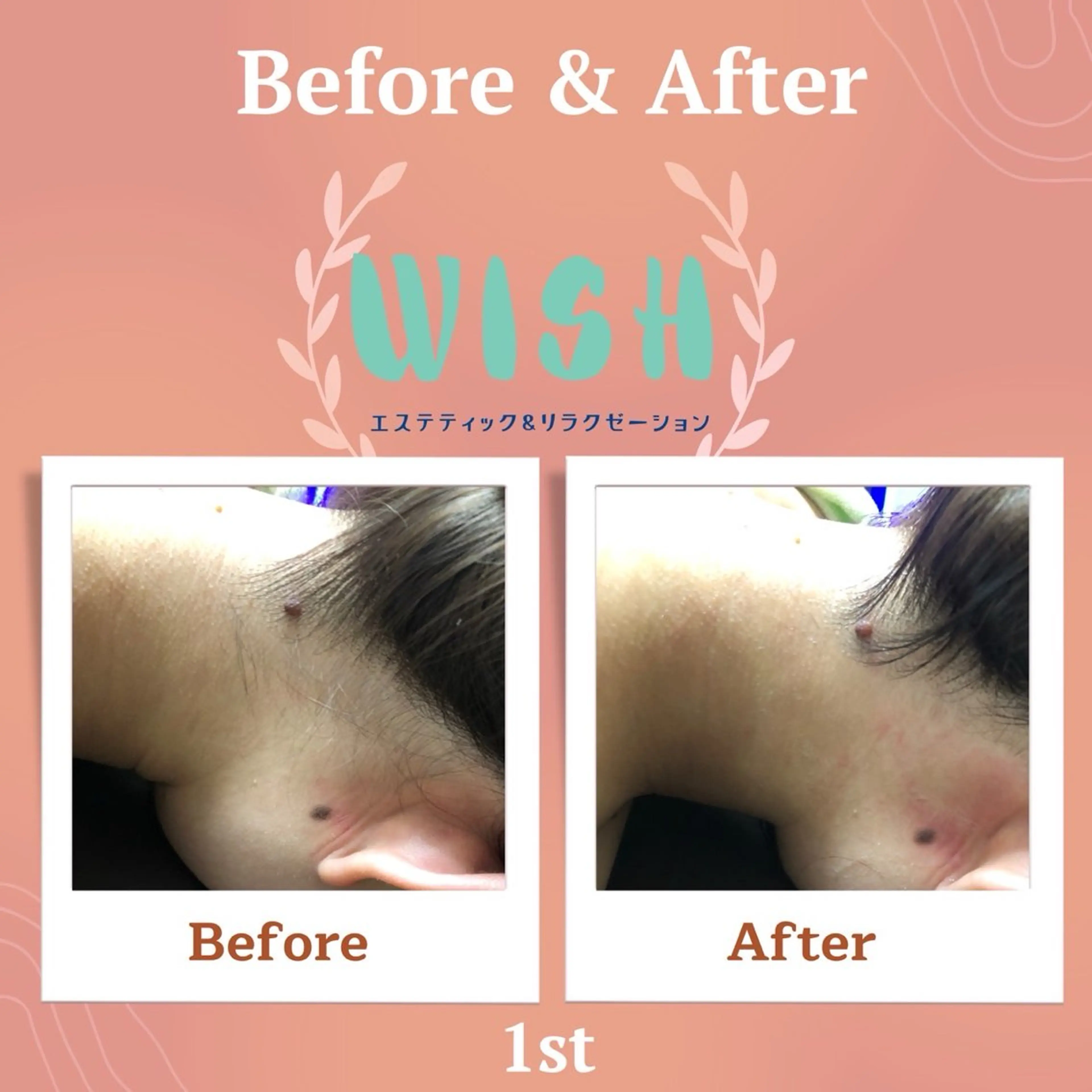WISH リラク×エステ 須藤のエステ・リラクイメージ