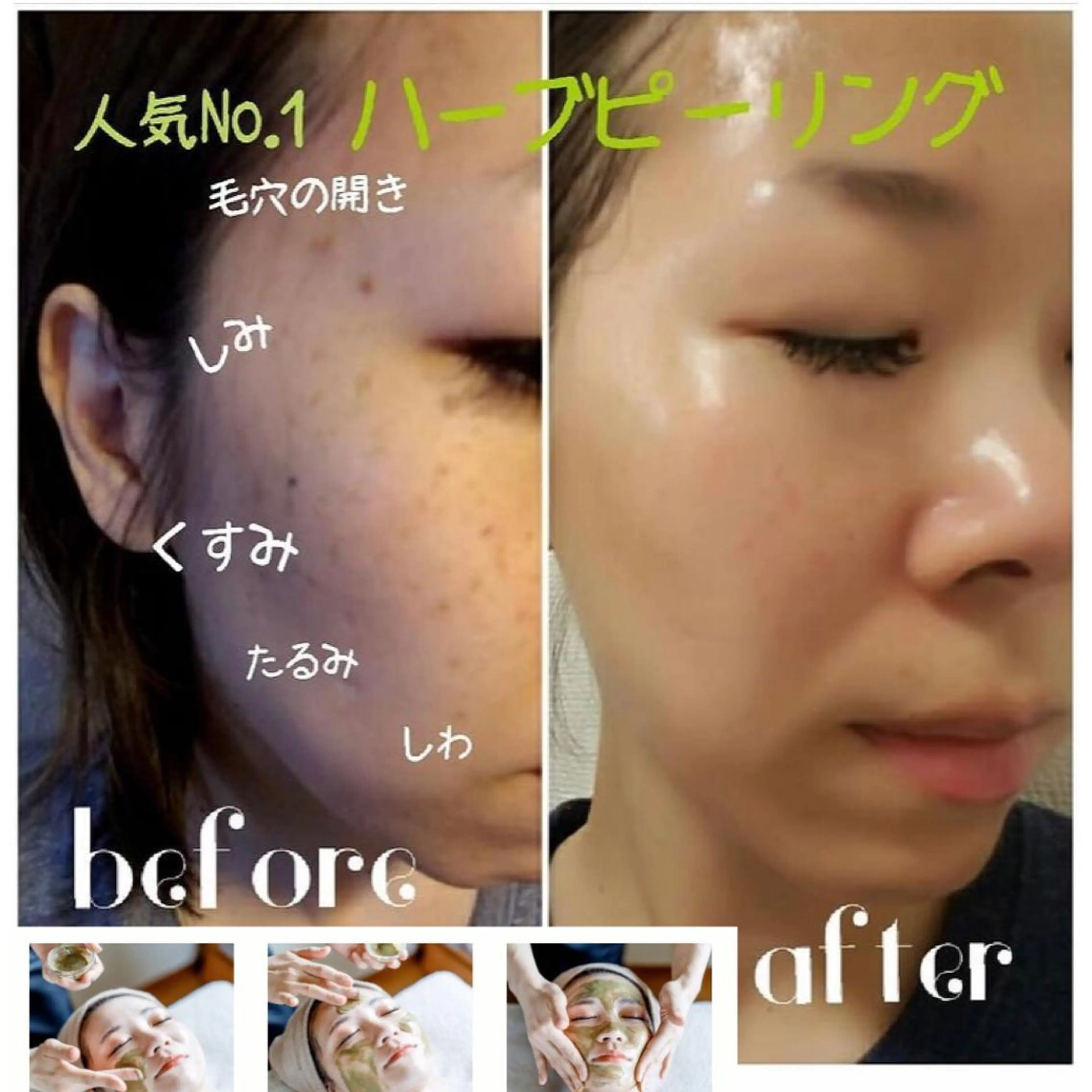 究極のアンチエイ ジングサロンのエステ・リラクイメージ
