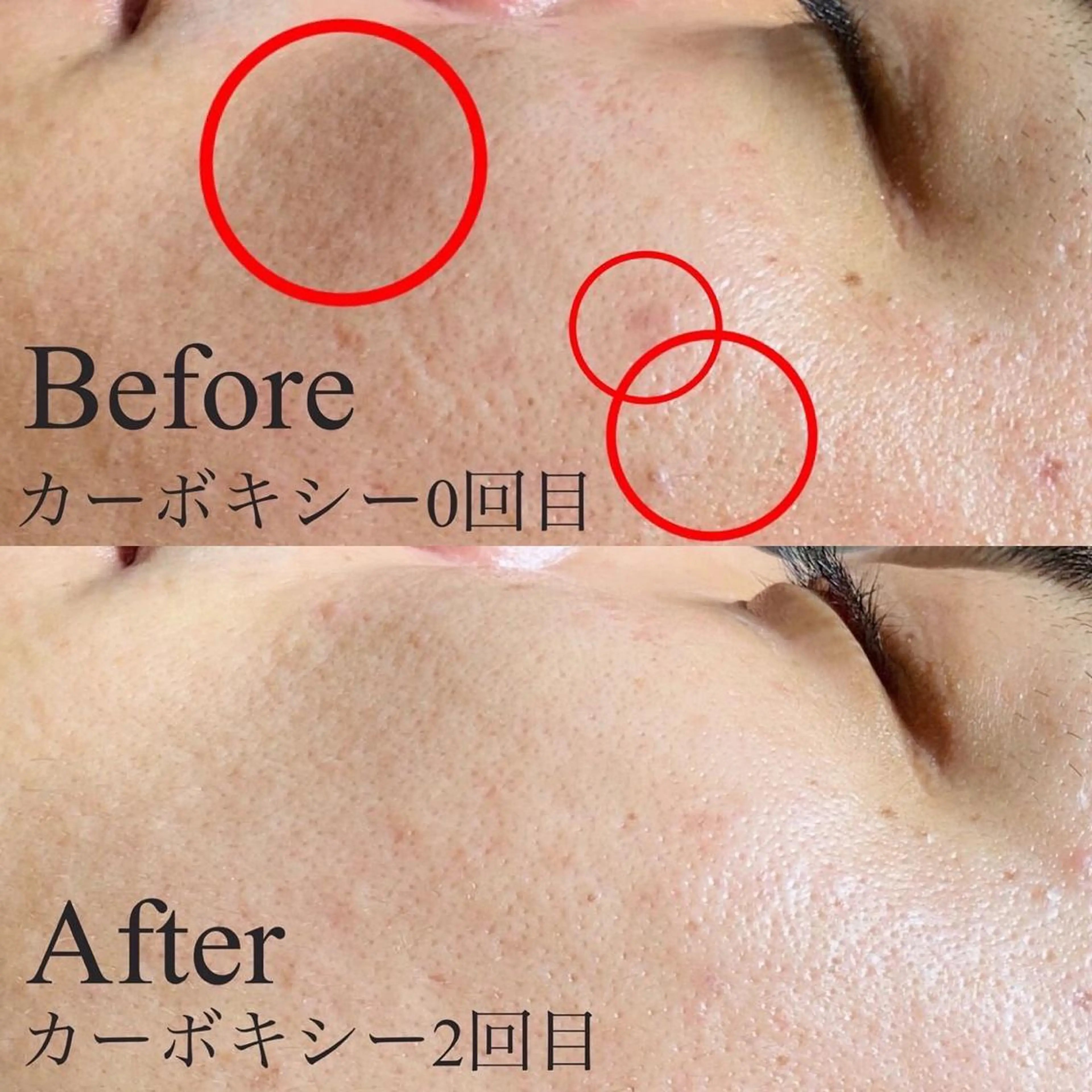 BELCIA福岡店 レコルトデベルシアのエステ・リラクイメージ