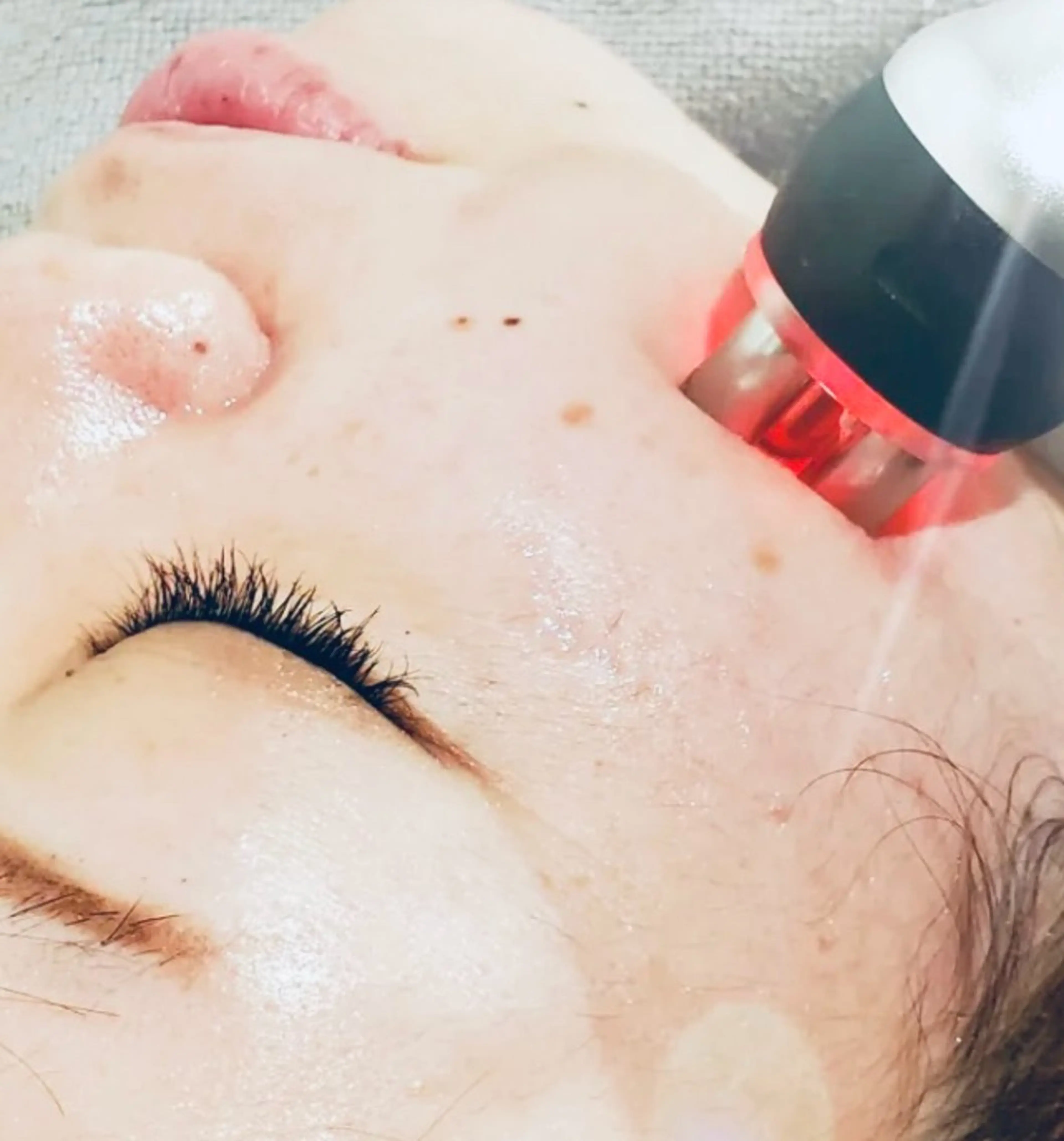 ❤️小顔実現❤️👘店長お薦め👘小顔コルギ+RF高周波小顔+バンテージ+引き締め石膏パック 💚 60分¥4380の写真