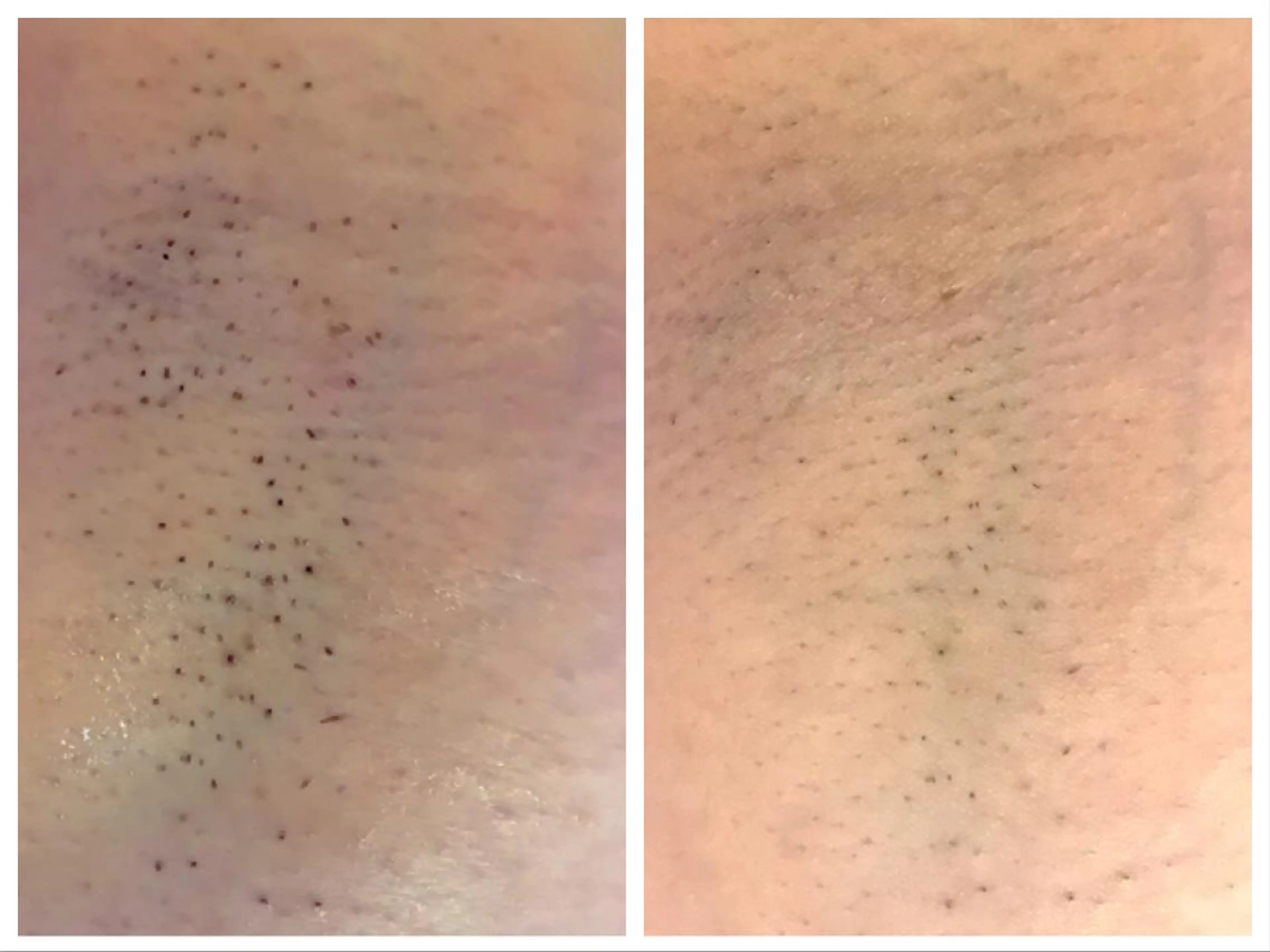 セレーネボーテプラス ローマピンク福岡のエステ・リラクイメージ