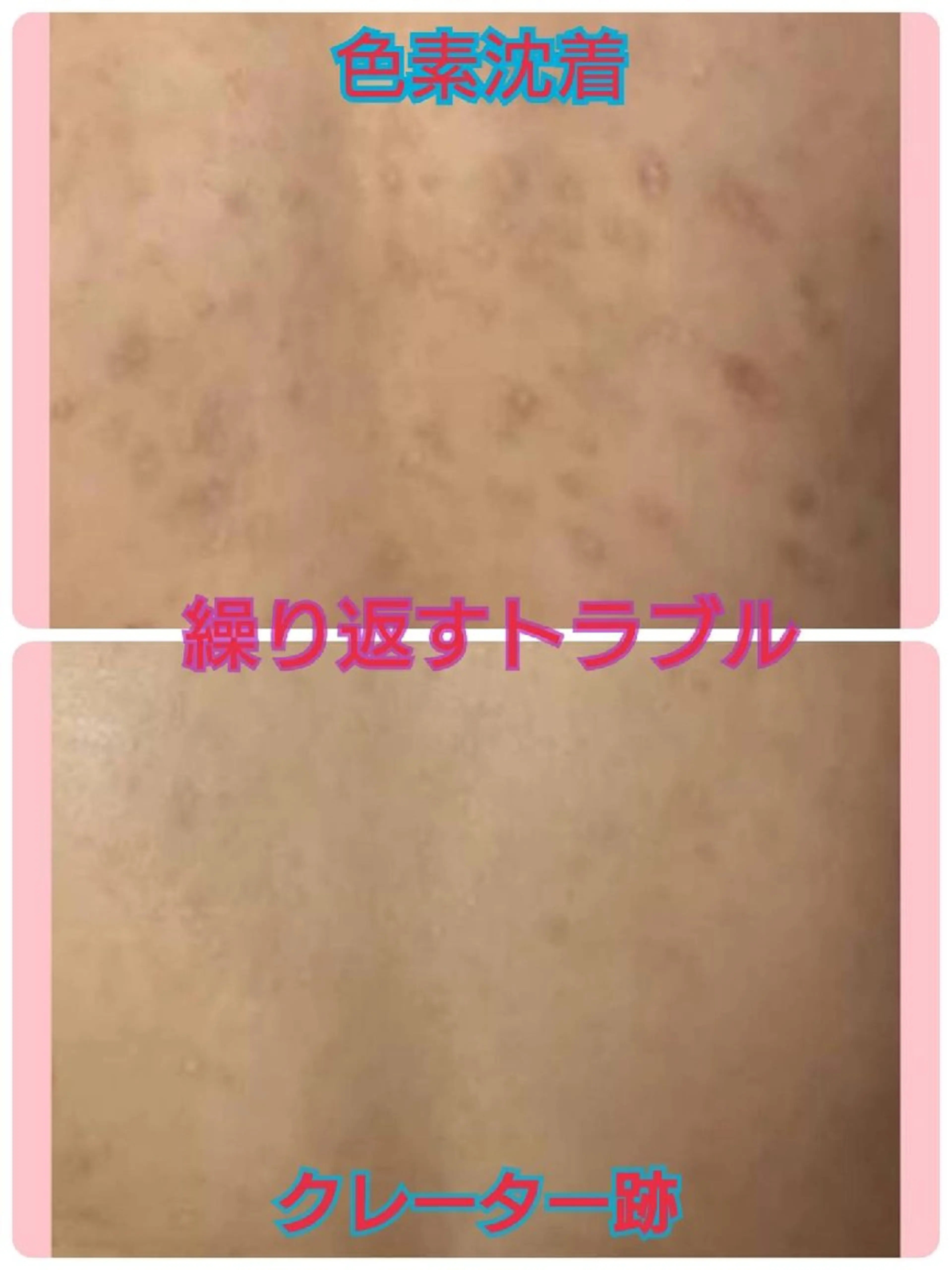 エステ ハーブピーリング 専門店Kikkaのエステ・リラクイメージ