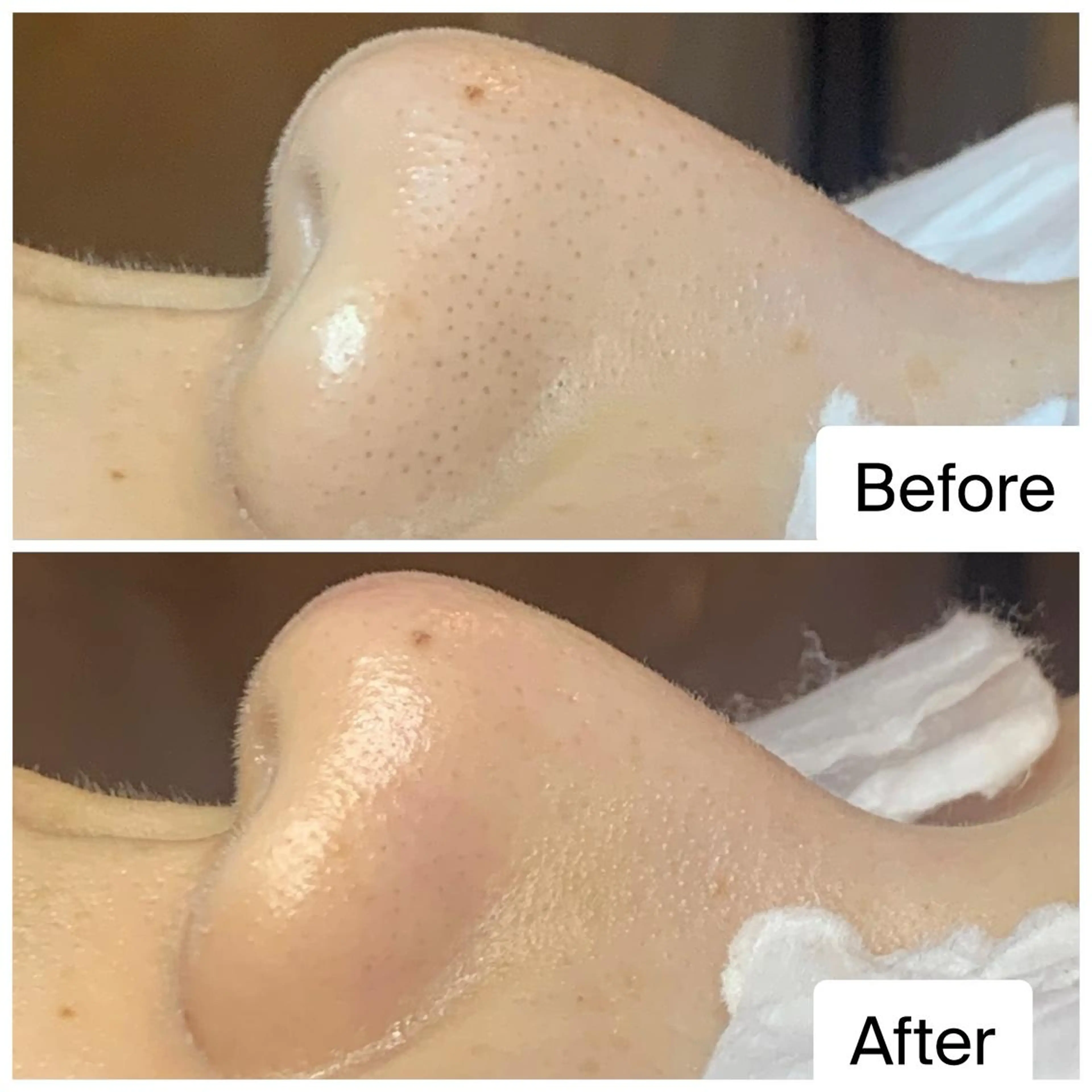 エステ ielu〜毛穴ケア ハーブピーリングのエステ・リラクイメージ