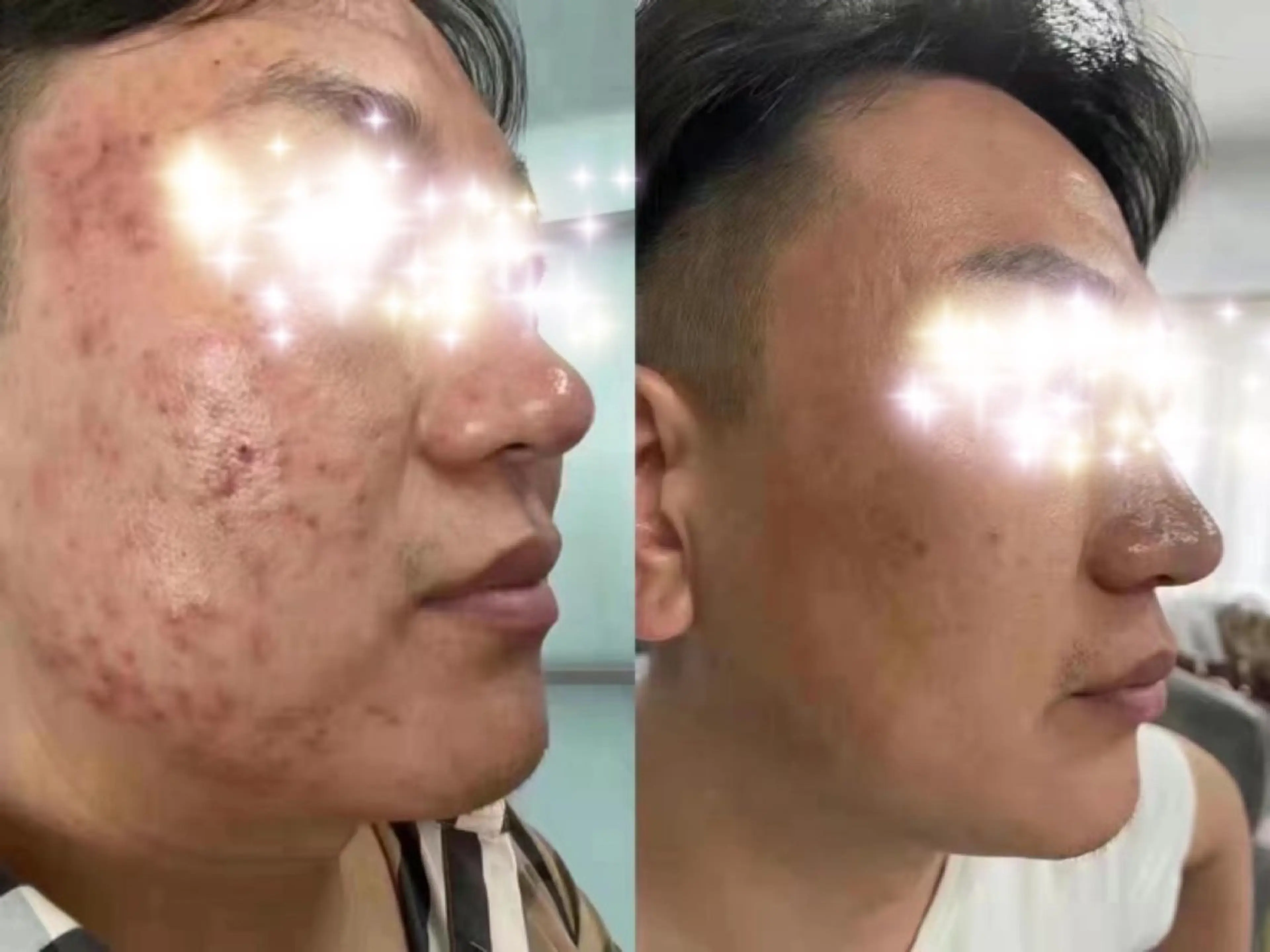 エステ リュー・.ド・ボウテ所属・肌質改善サロン★ リュー・ド・ボウテのエステ・リラクイメージ