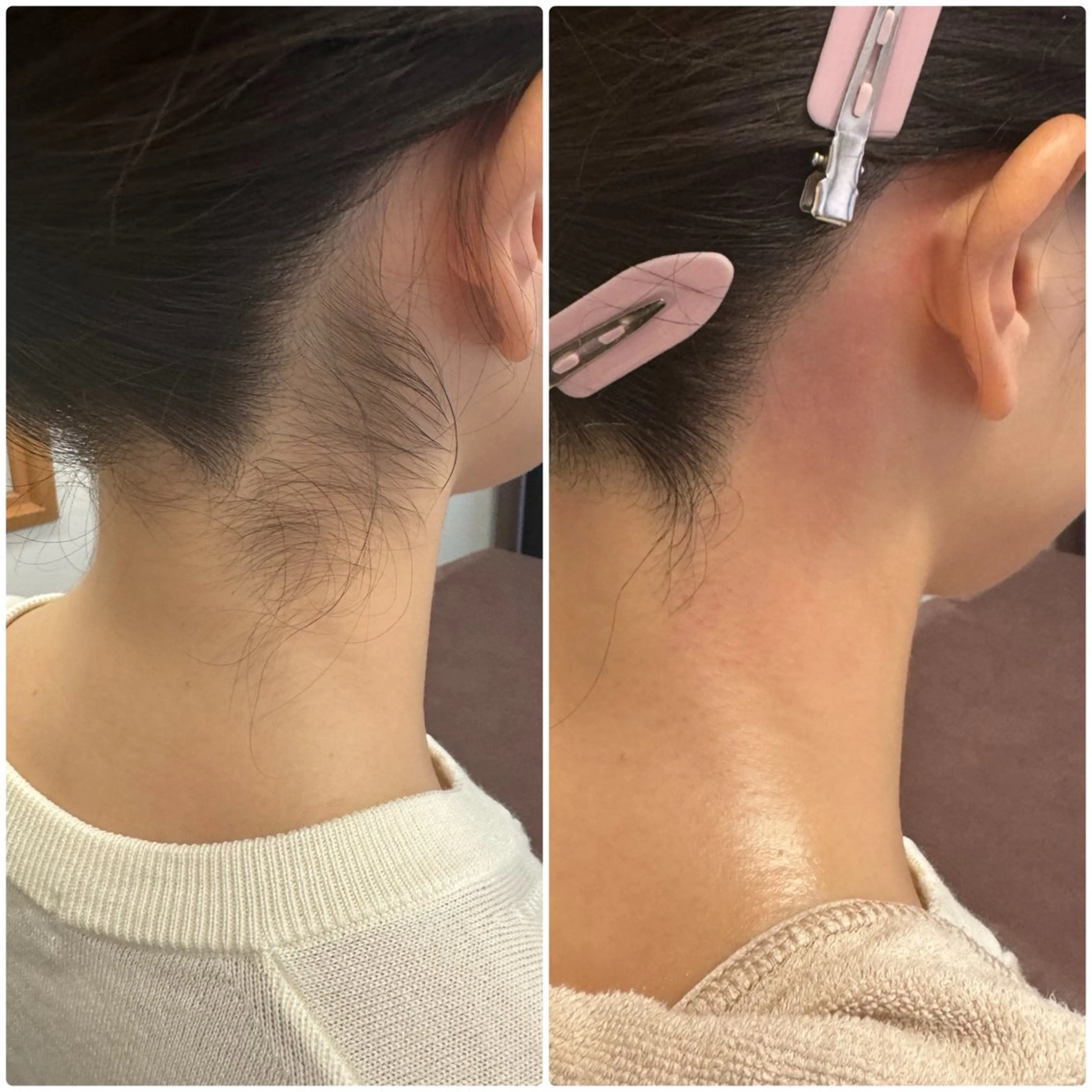 脱毛 meow by hug.所属・恵比寿🌻ワックス 顔うなじVIOワキのエステ・リラクイメージ